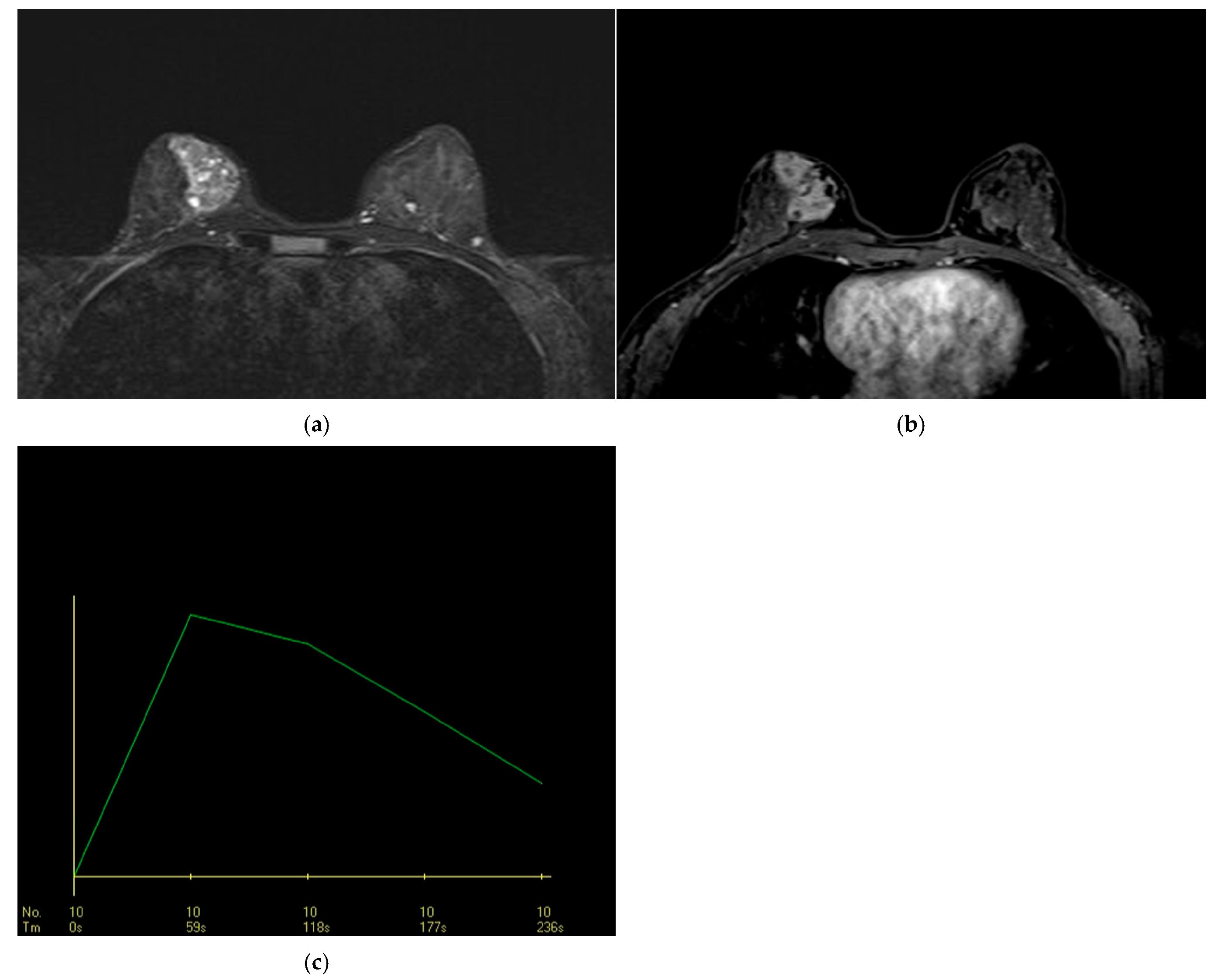 Diagnostics 15 03084 g004