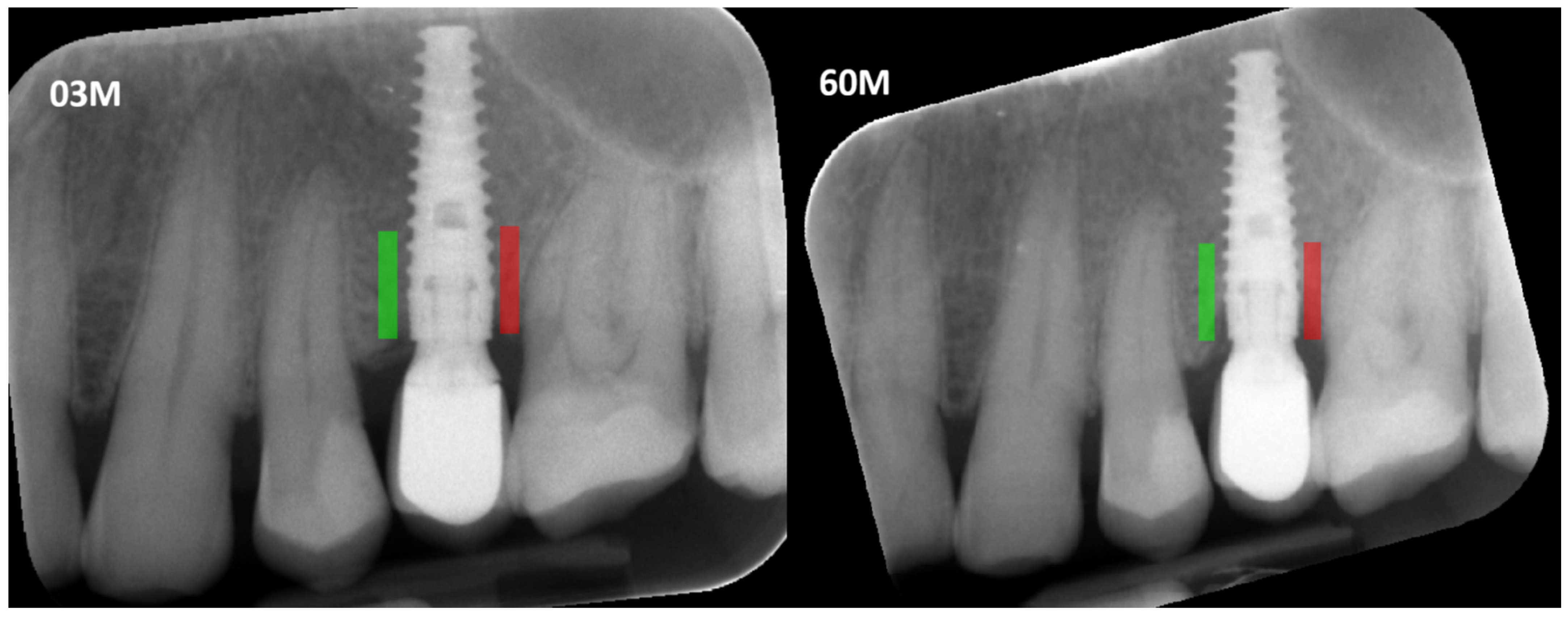 Diagnostics 15 03101 g001 Diagnostics 15 03101 g001