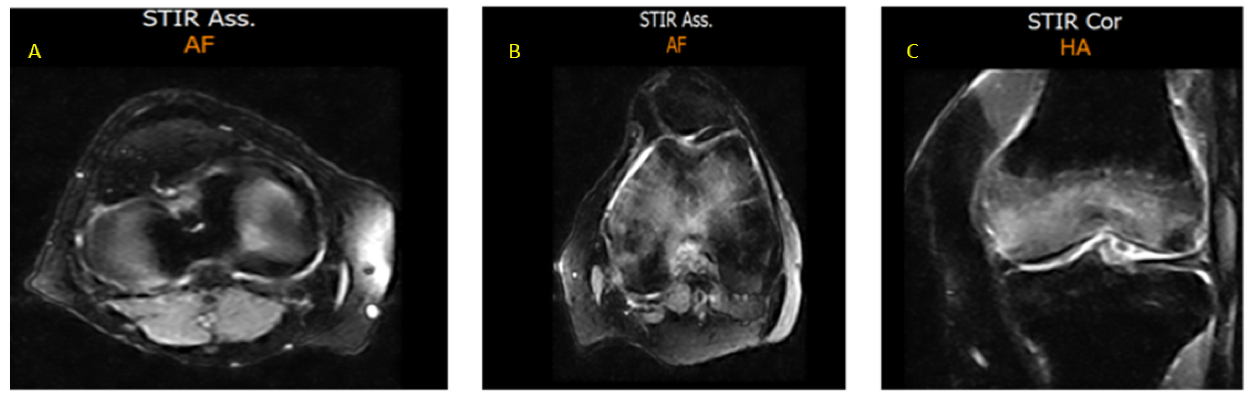 Diagnostics 15 03112 g003 Diagnostics 15 03112 g003
