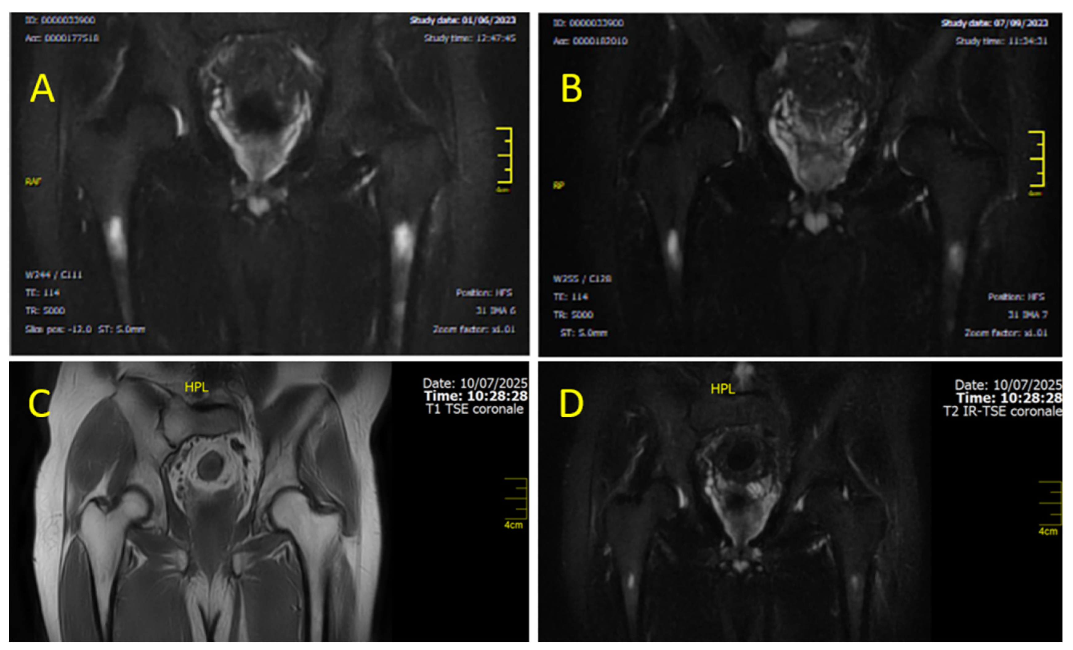 Diagnostics 15 03112 g006 Diagnostics 15 03112 g006