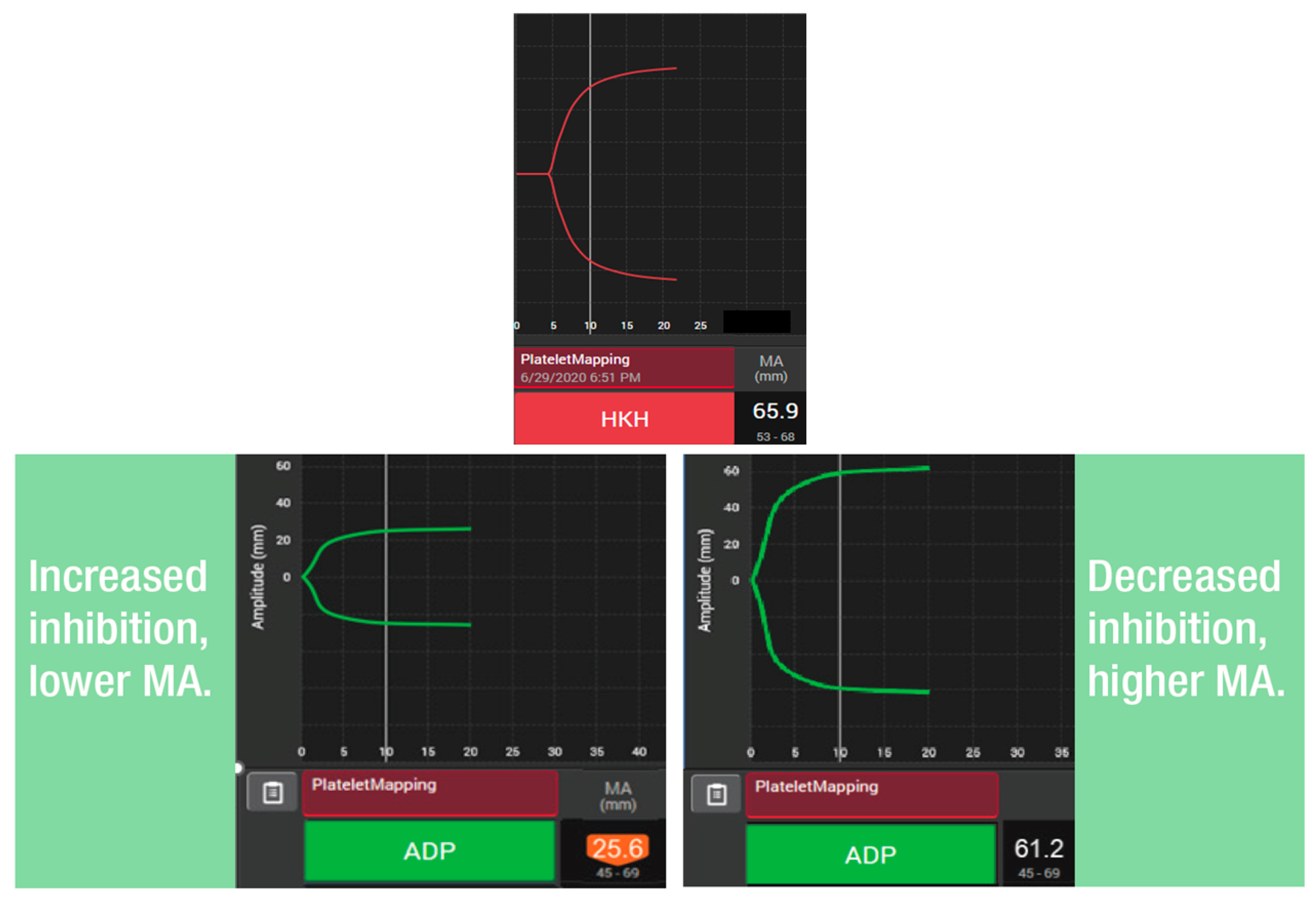 Diagnostics 15 03113 g002 Diagnostics 15 03113 g002