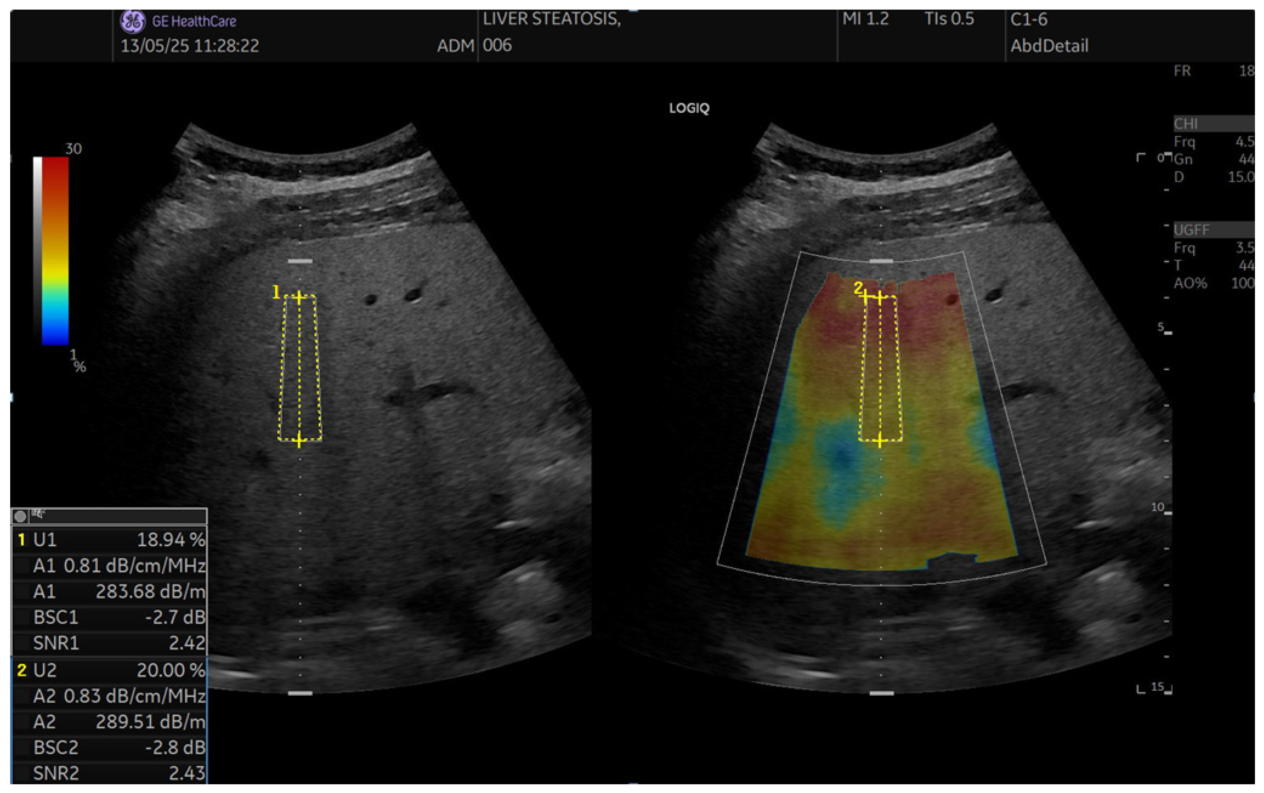 Diagnostics 15 03119 g002 Diagnostics 15 03119 g002