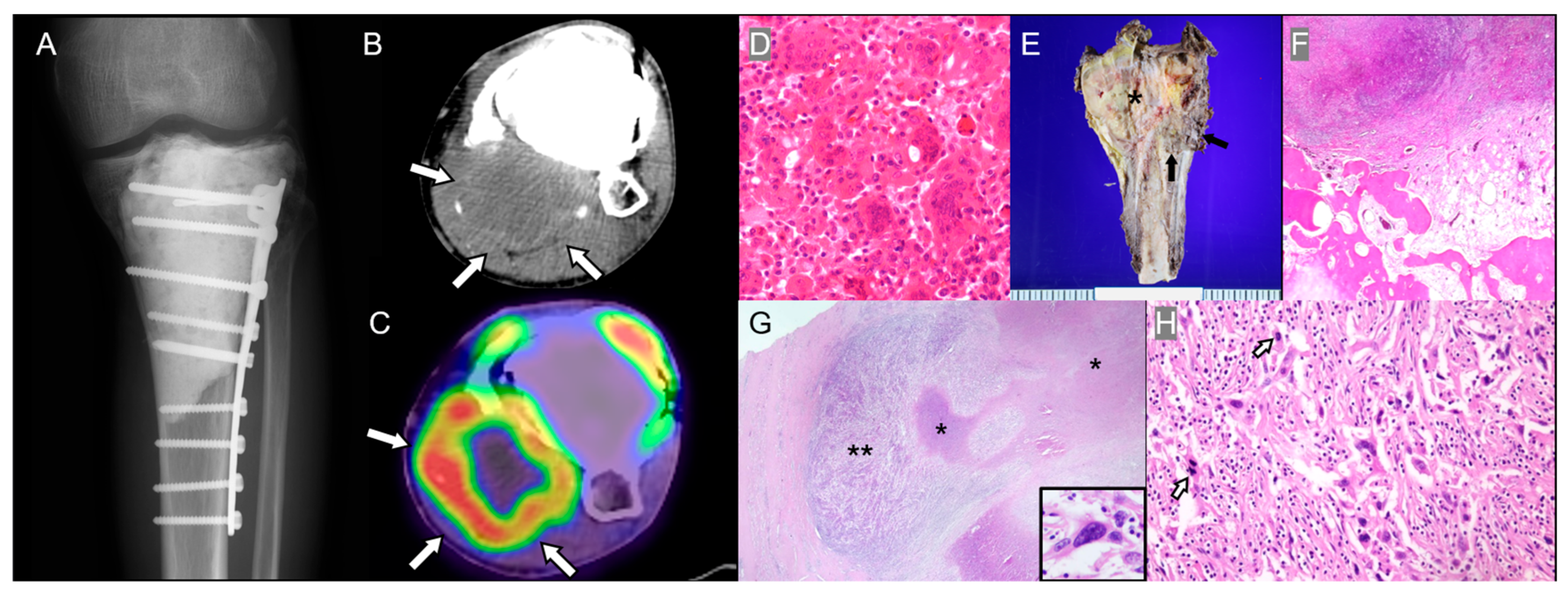 Diagnostics 15 03120 g003 Diagnostics 15 03120 g003