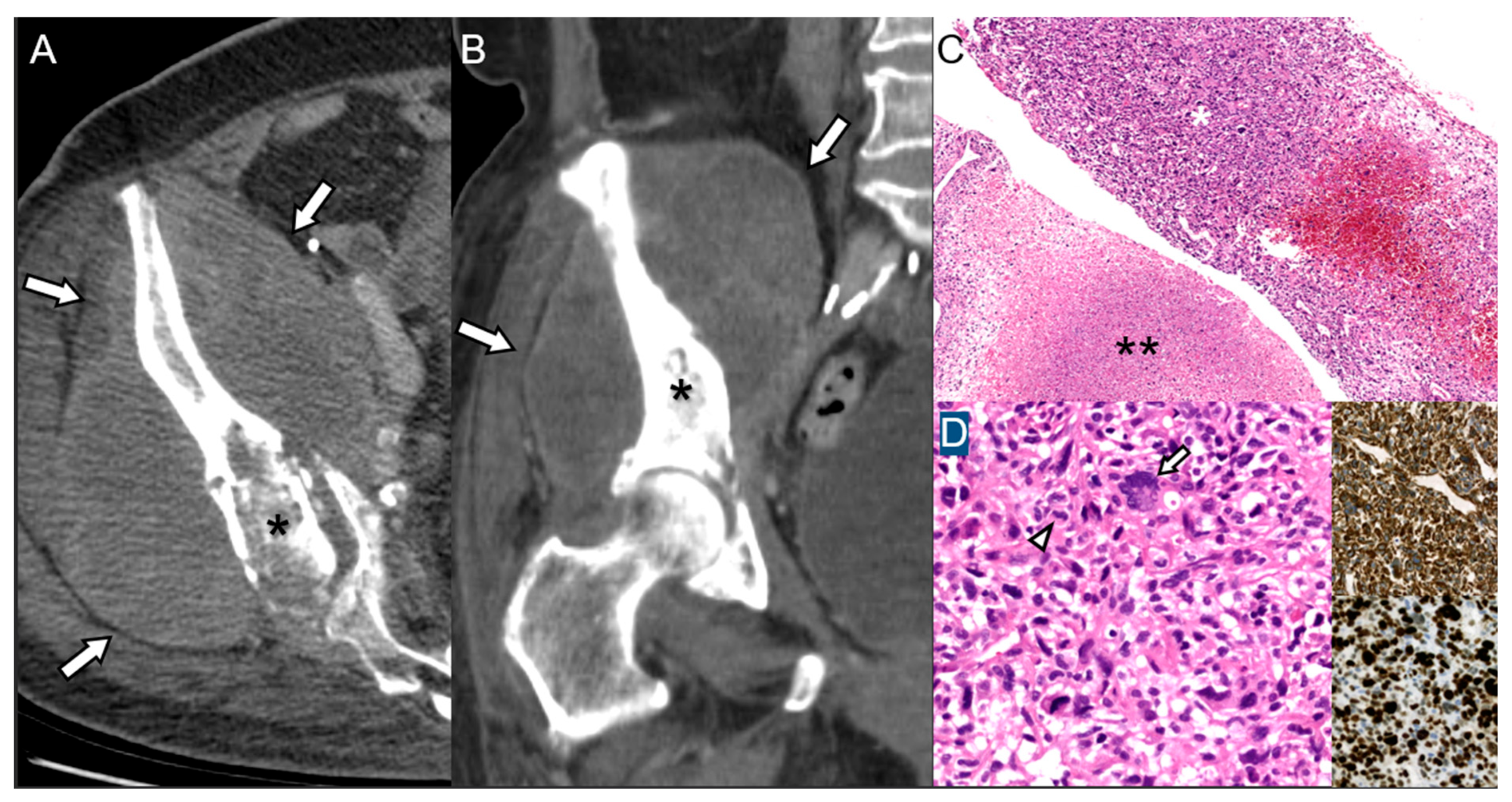 Diagnostics 15 03120 g005 Diagnostics 15 03120 g005