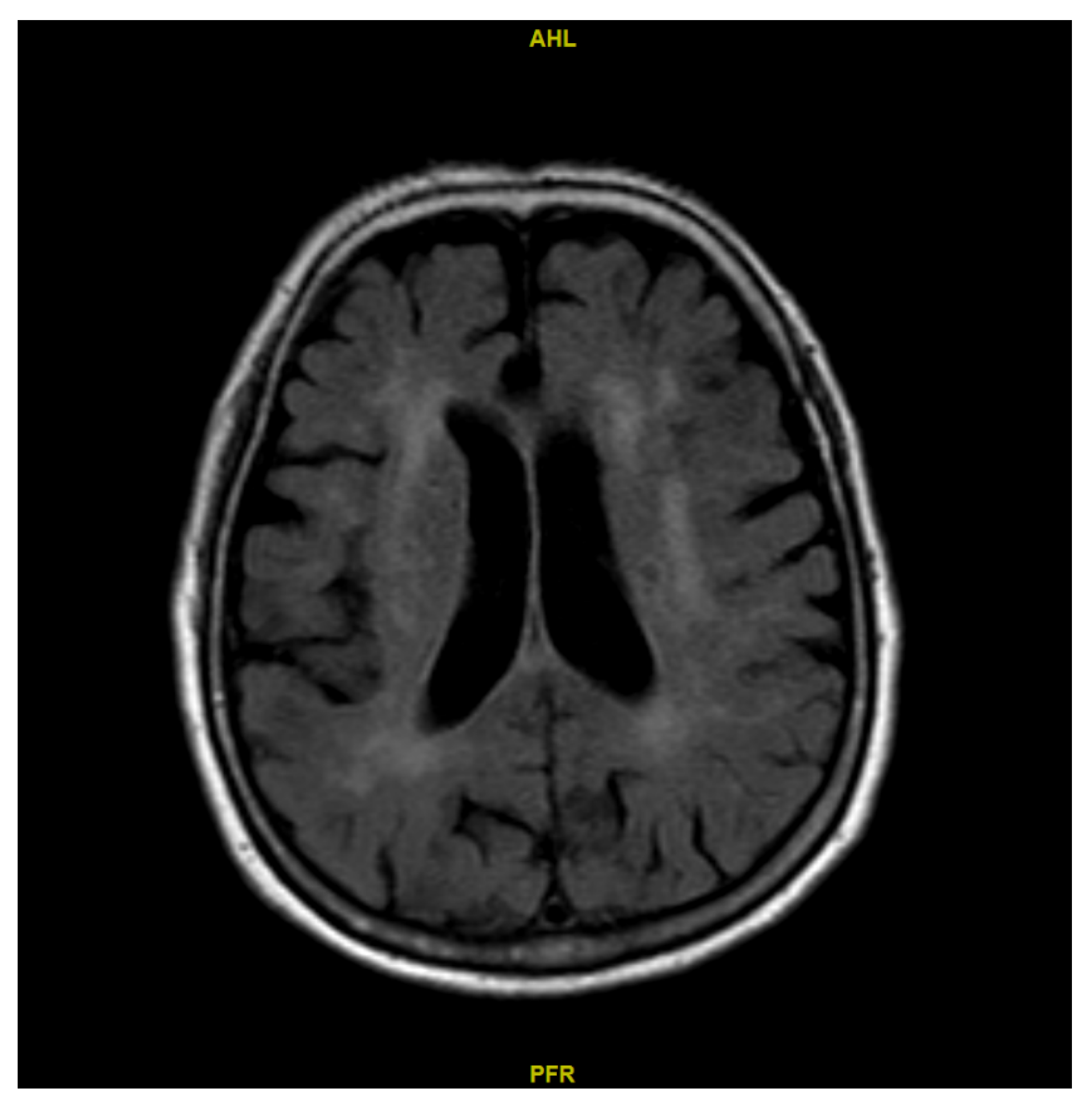 Diagnostics 15 03126 g002 Diagnostics 15 03126 g002