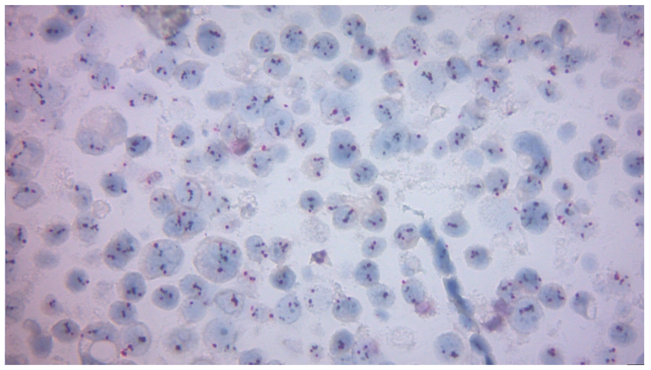 Diagnostics 15 03128 g004 Diagnostics 15 03128 g004