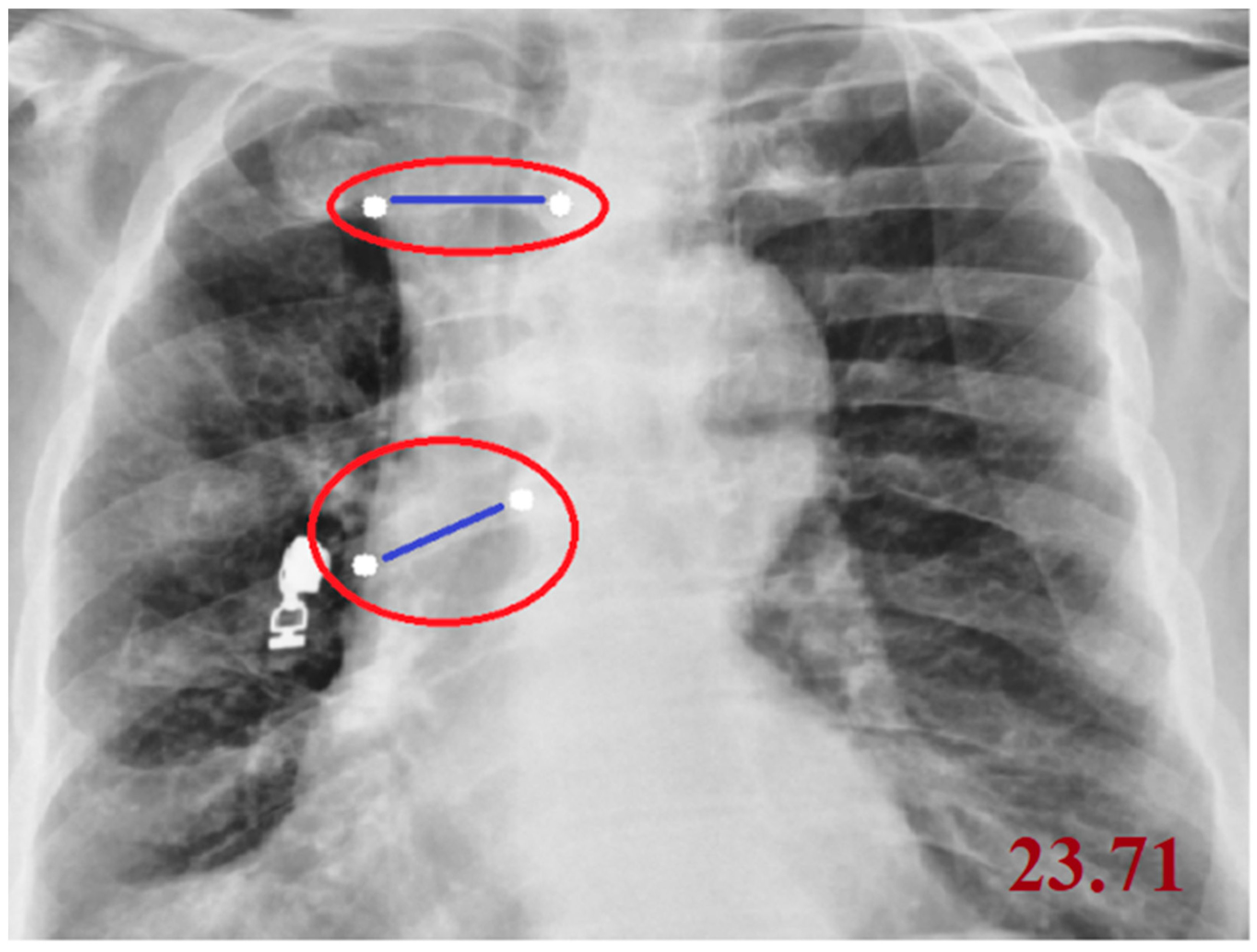 Diagnostics 15 03138 g001 Diagnostics 15 03138 g001