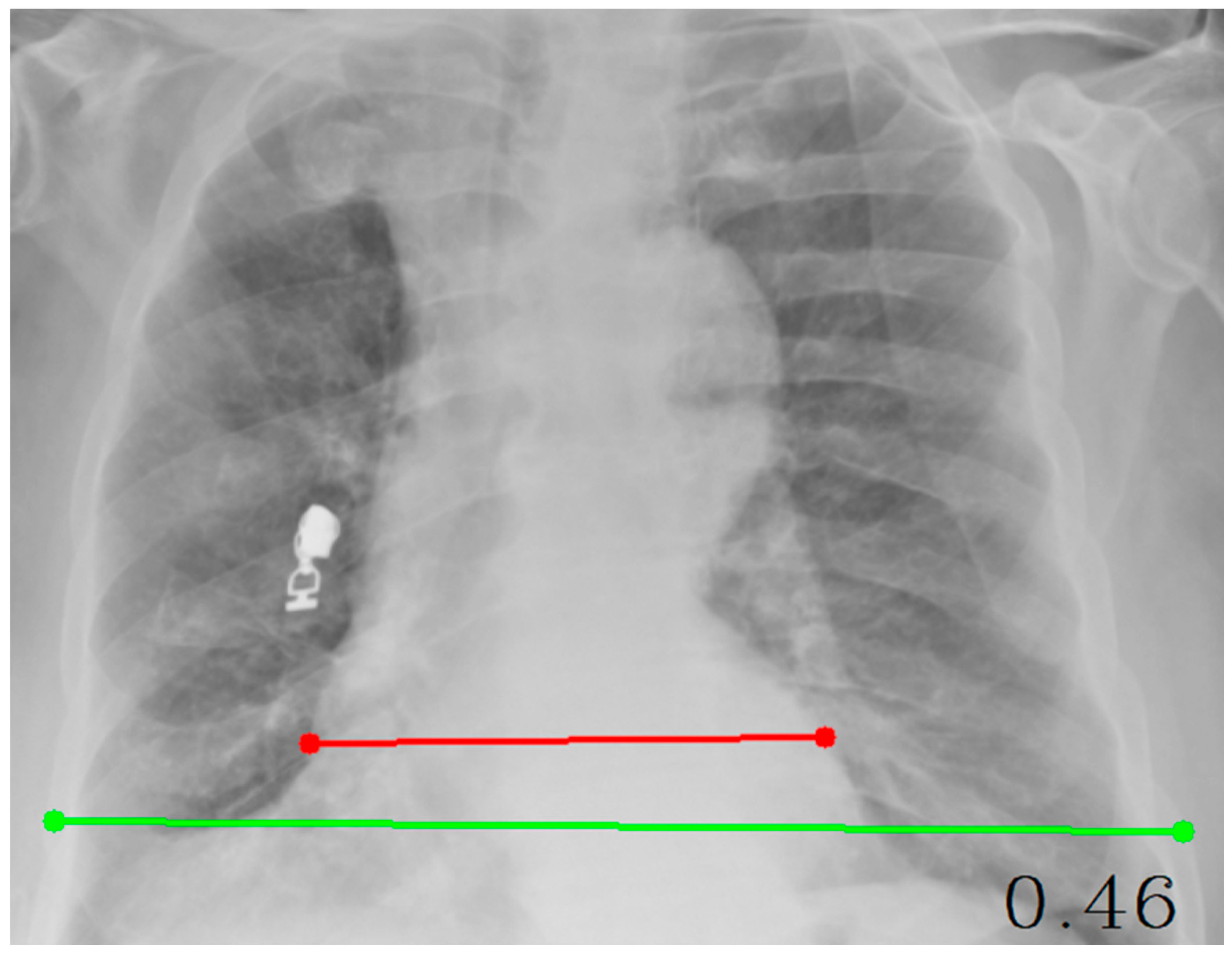 Diagnostics 15 03138 g002 Diagnostics 15 03138 g002