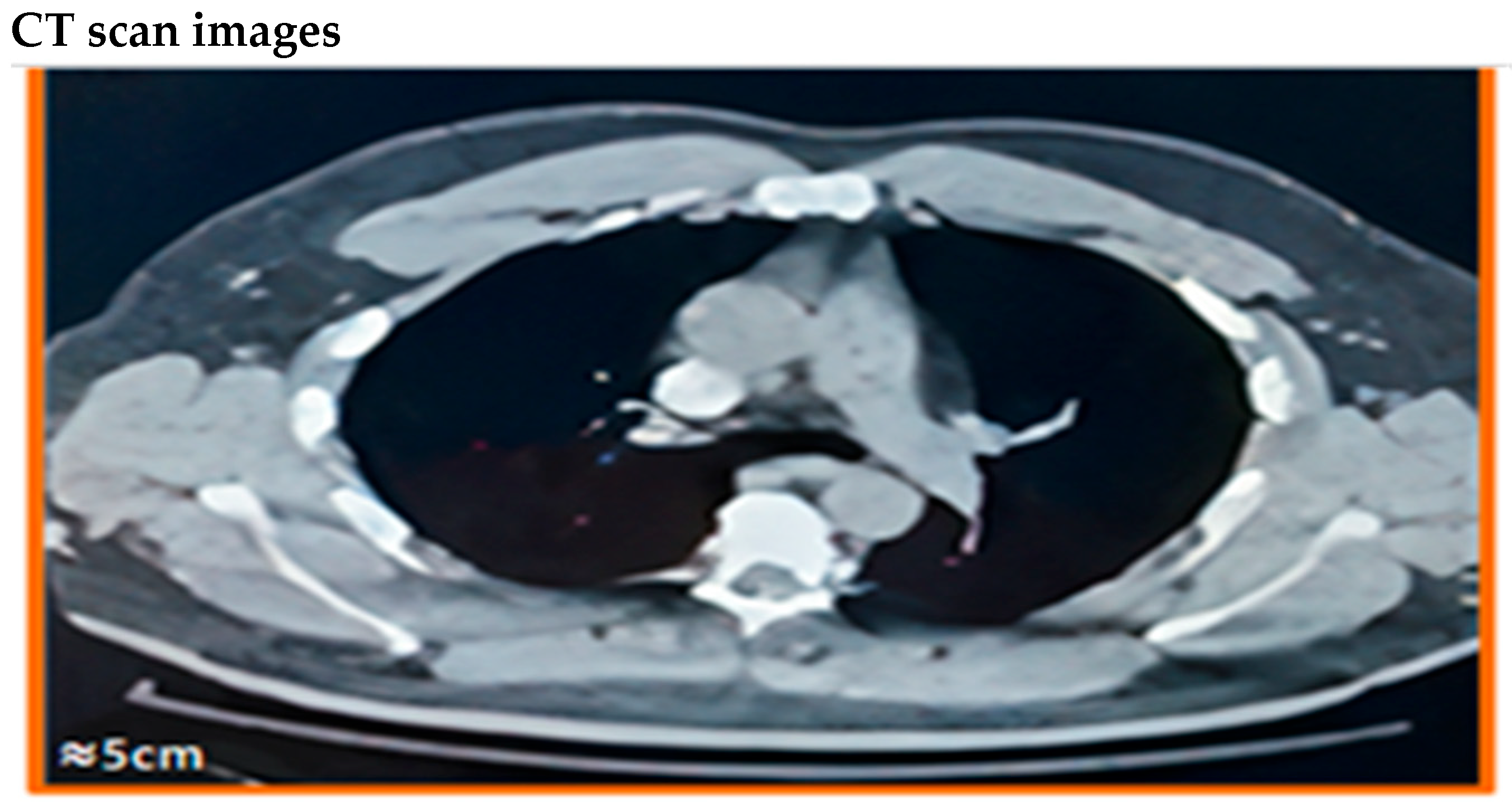 Diagnostics 15 03148 g011 Diagnostics 15 03148 g011