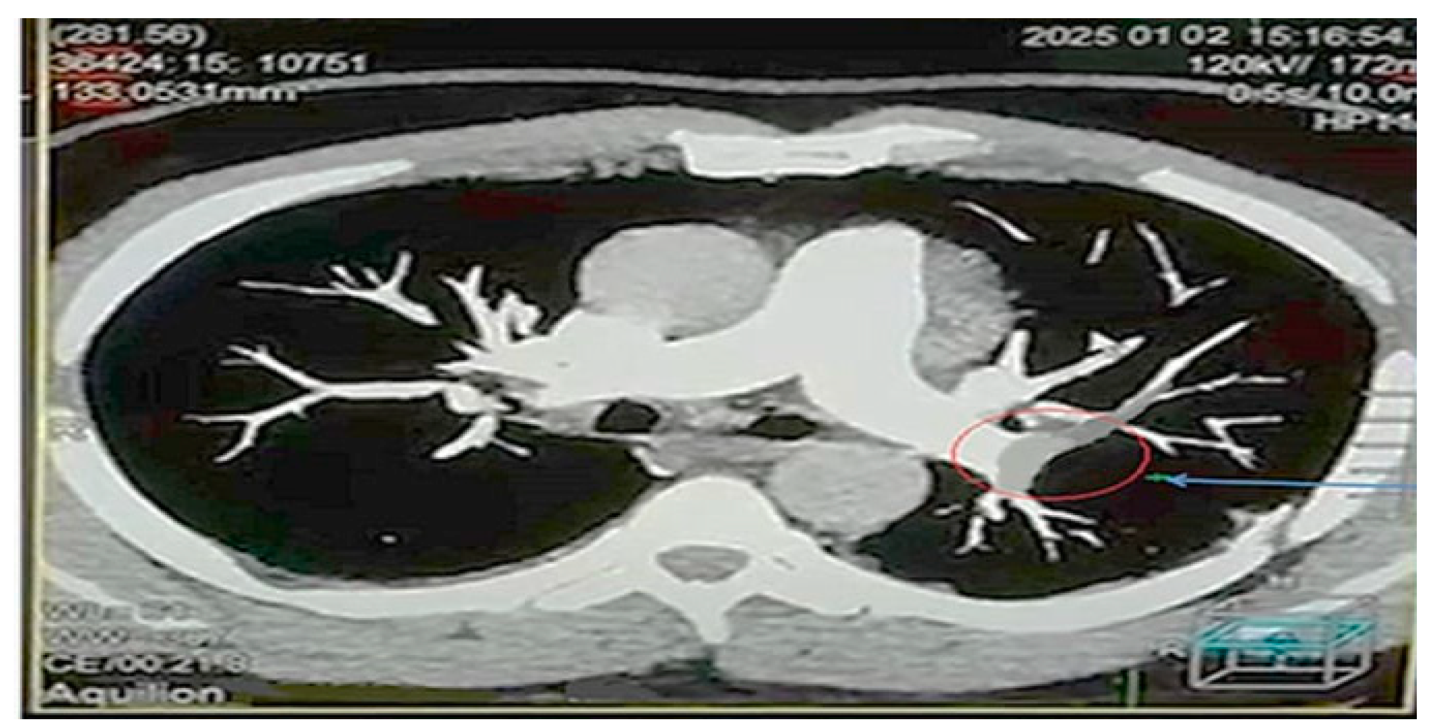 Diagnostics 15 03148 g012 Diagnostics 15 03148 g012