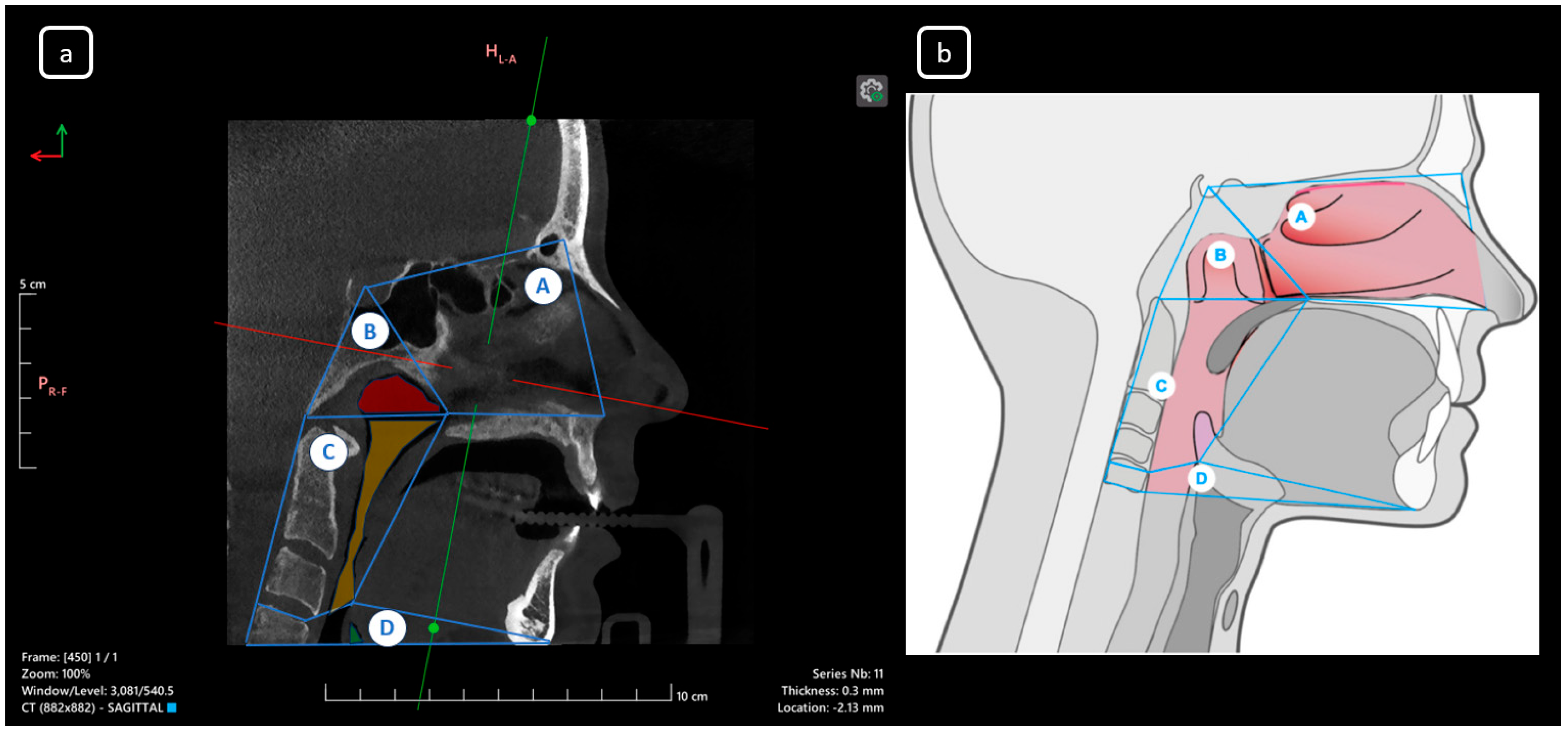 Diagnostics 15 03157 g002 Diagnostics 15 03157 g002