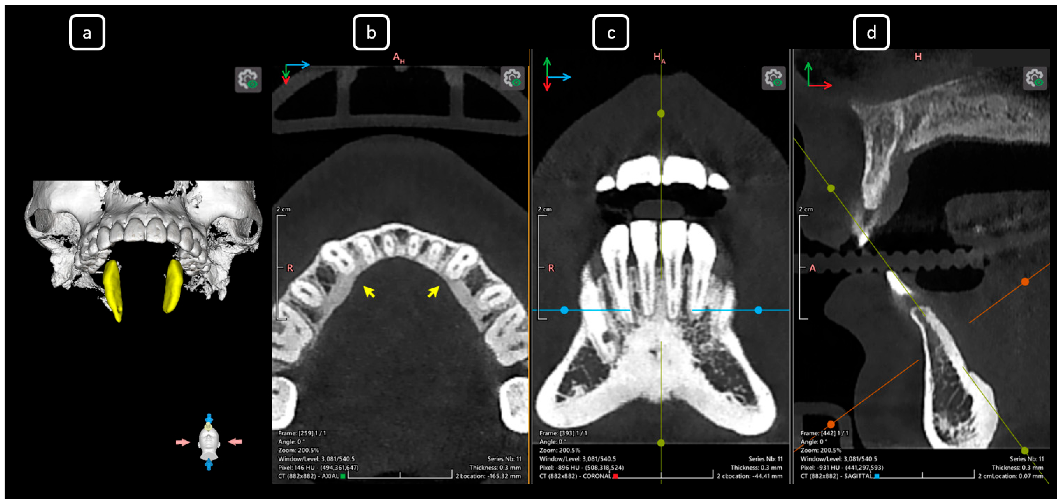 Diagnostics 15 03157 g005 Diagnostics 15 03157 g005