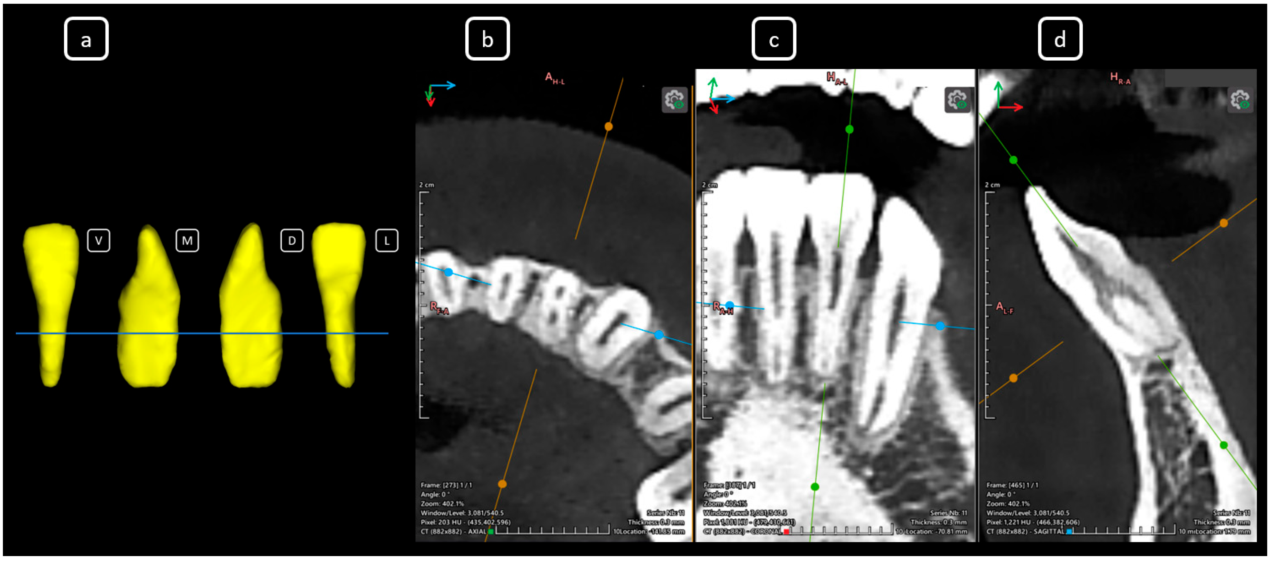 Diagnostics 15 03157 g007 Diagnostics 15 03157 g007