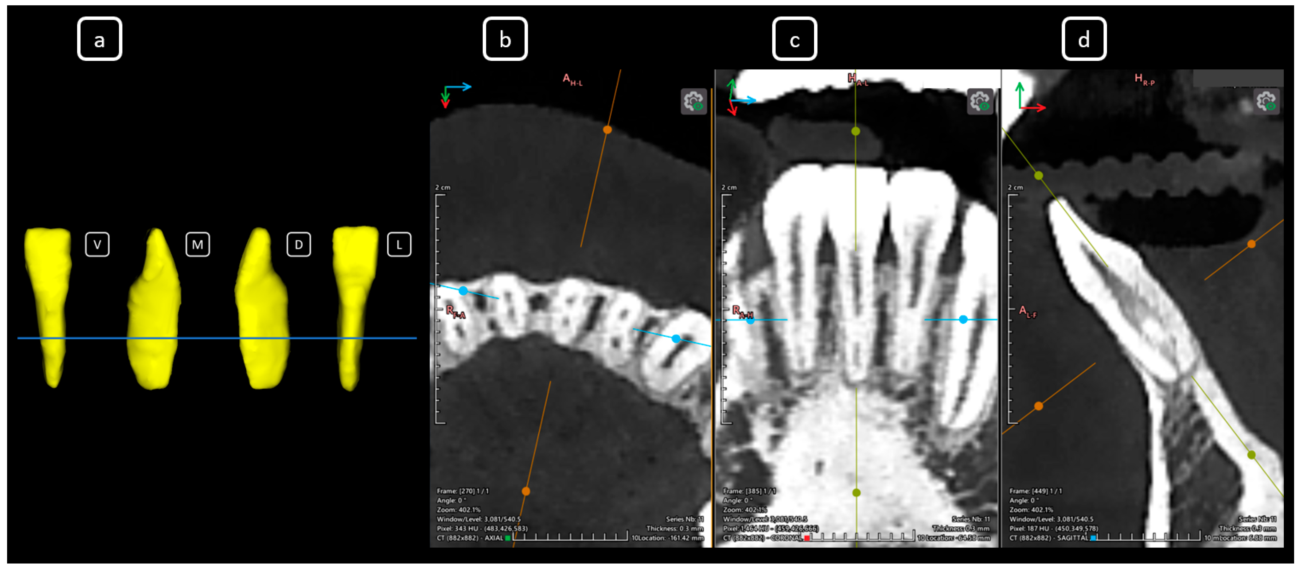Diagnostics 15 03157 g008 Diagnostics 15 03157 g008