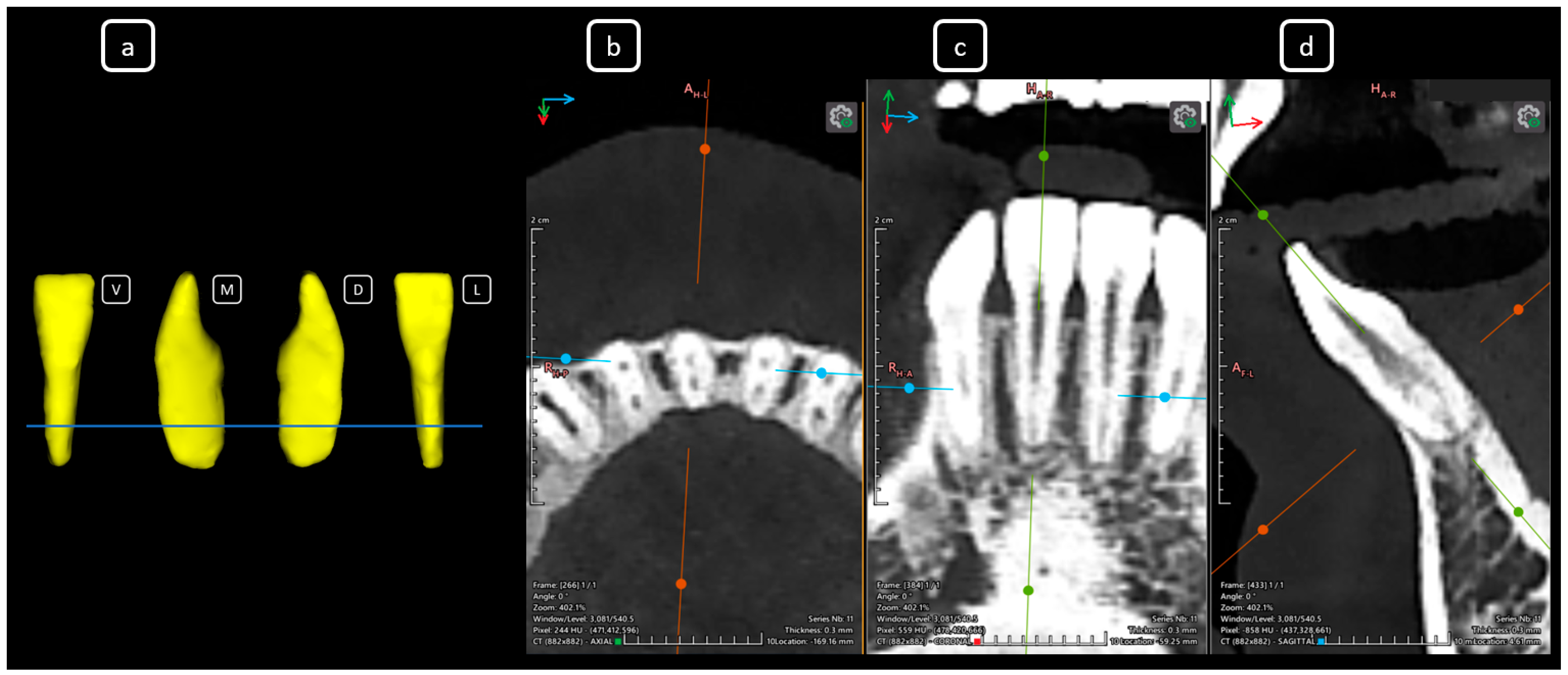 Diagnostics 15 03157 g009 Diagnostics 15 03157 g009