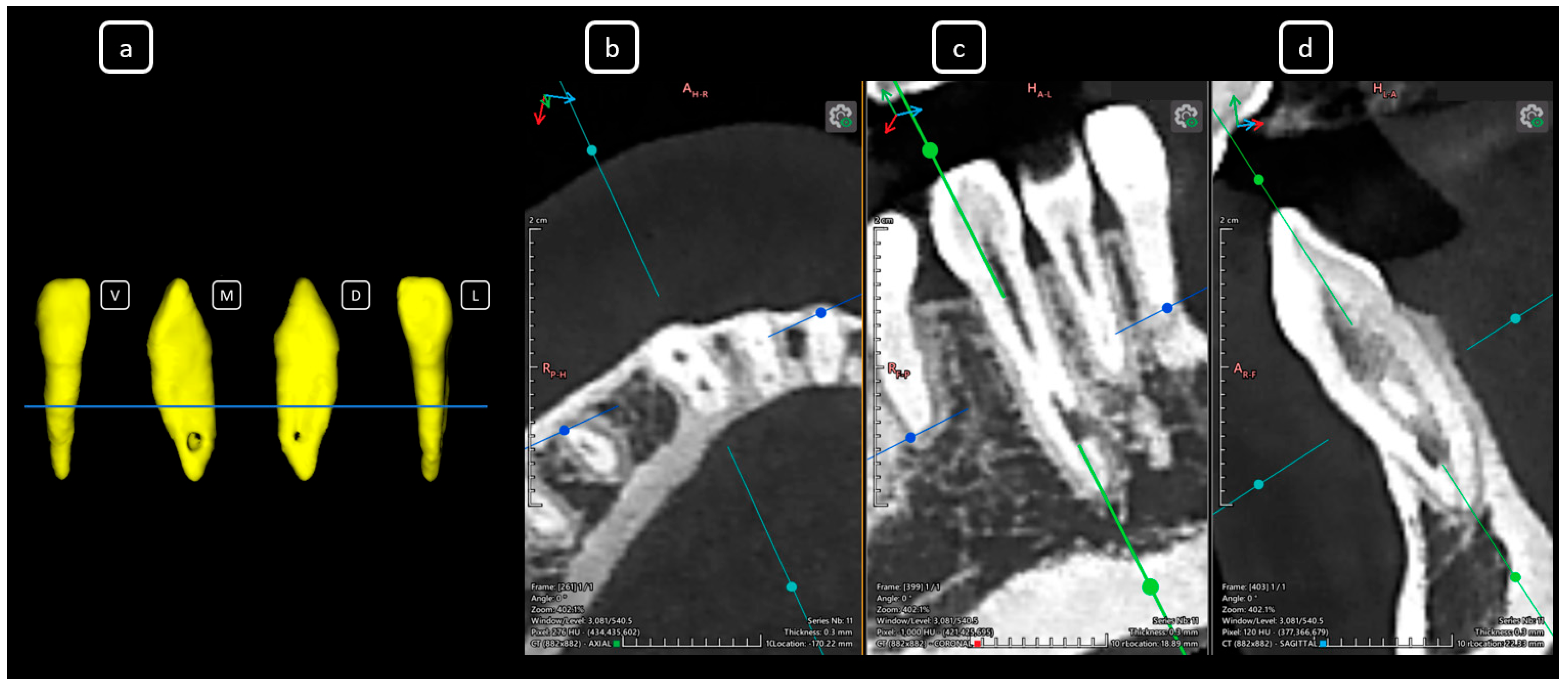 Diagnostics 15 03157 g011 Diagnostics 15 03157 g011