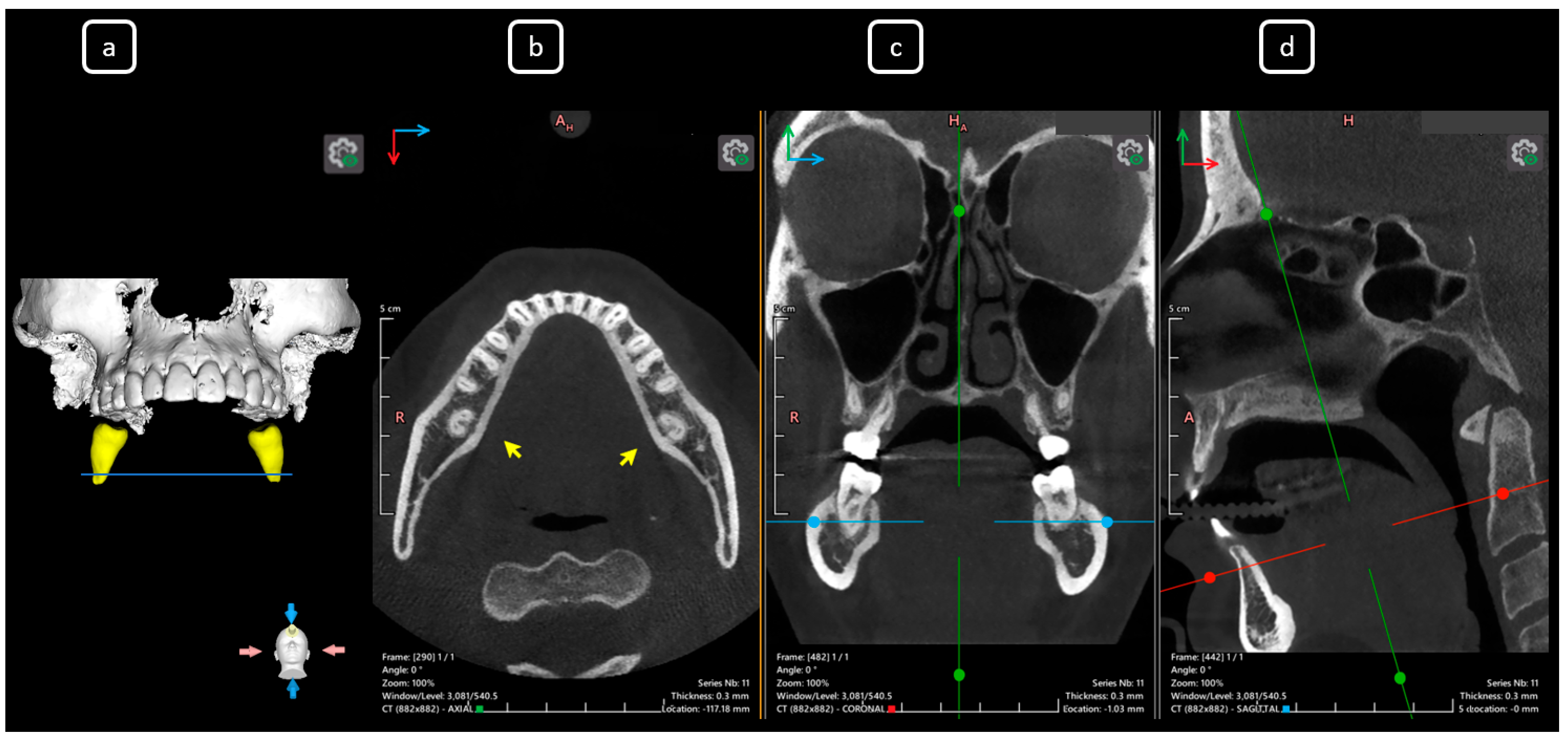 Diagnostics 15 03157 g015 Diagnostics 15 03157 g015