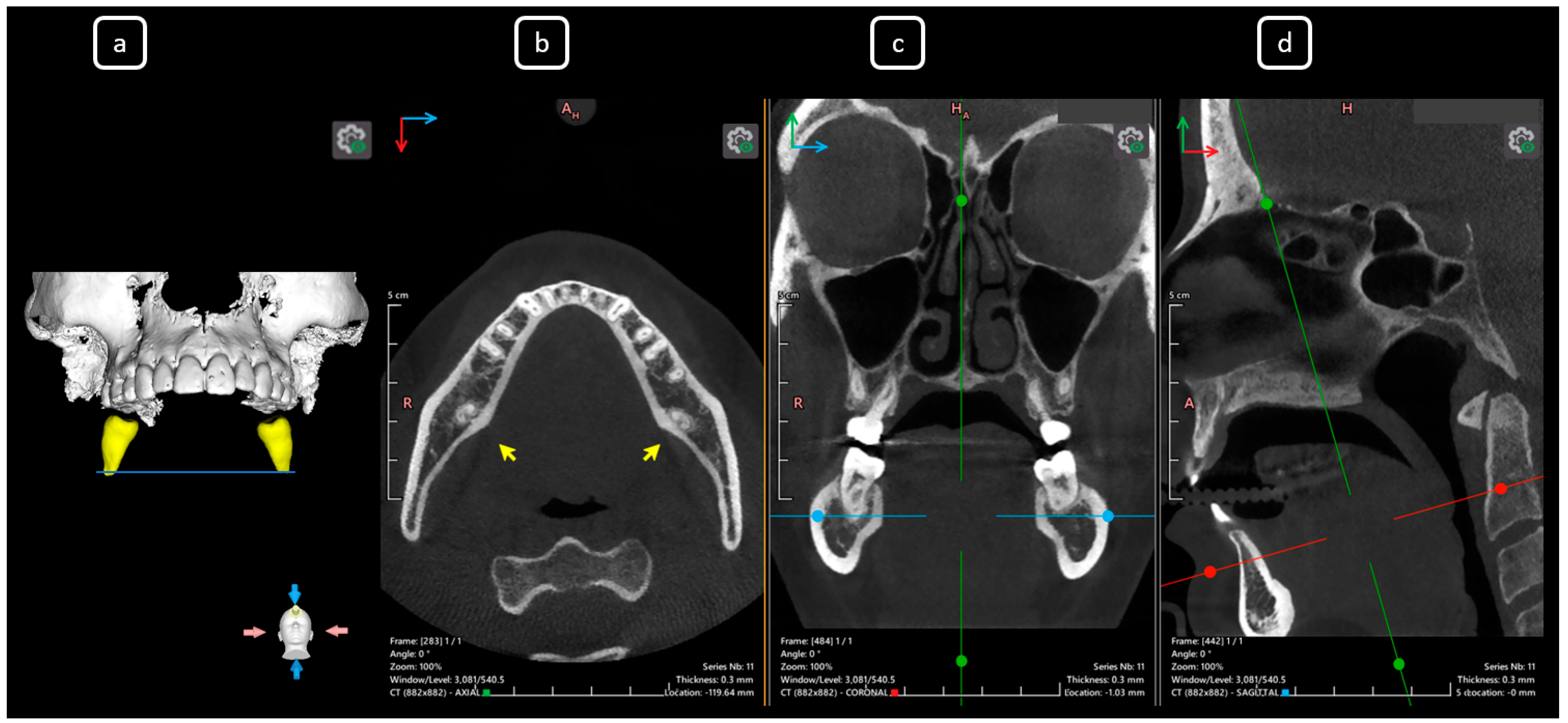 Diagnostics 15 03157 g016 Diagnostics 15 03157 g016