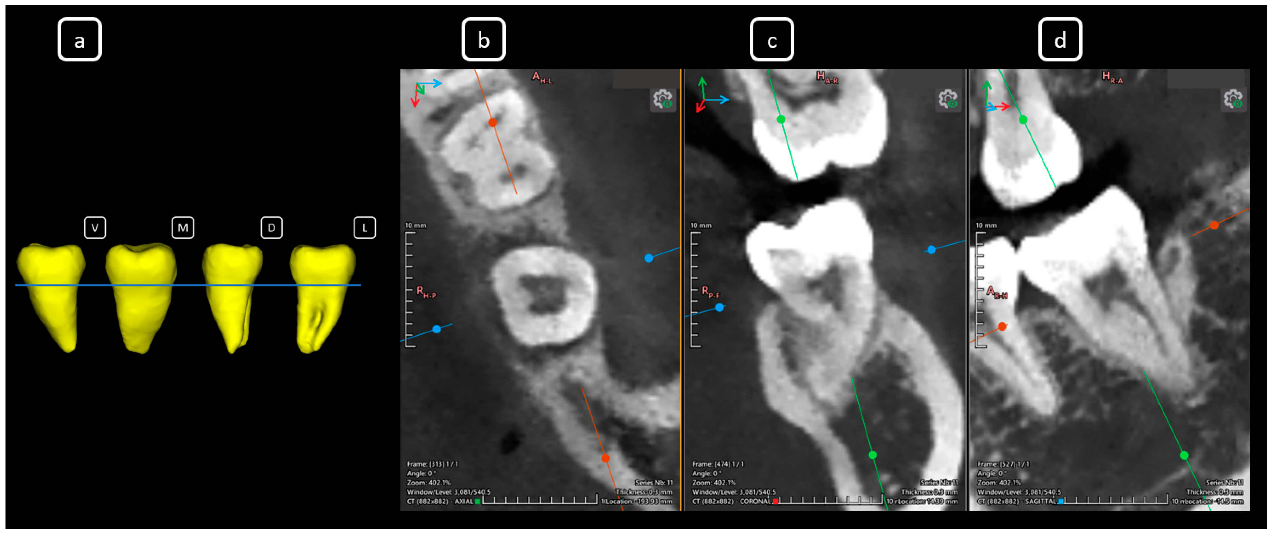 Diagnostics 15 03157 g017 Diagnostics 15 03157 g017