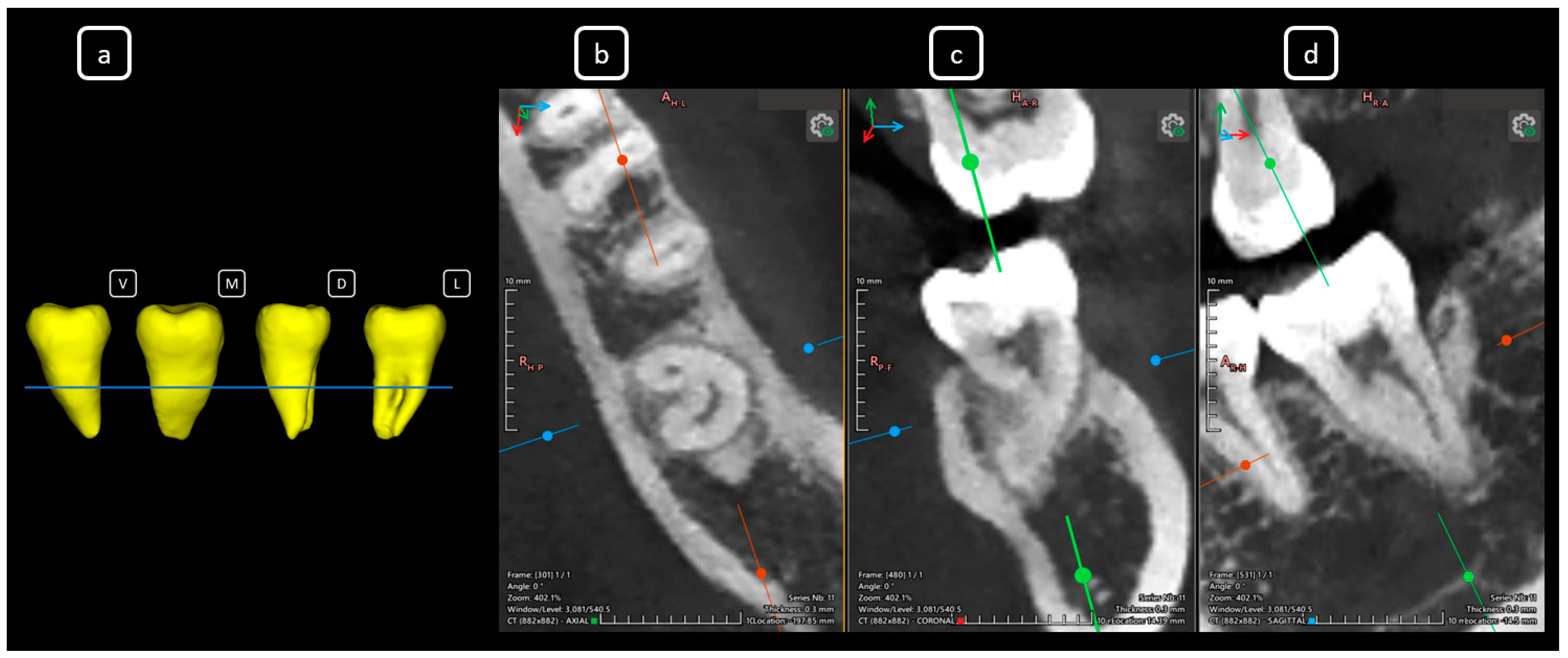 Diagnostics 15 03157 g018 Diagnostics 15 03157 g018