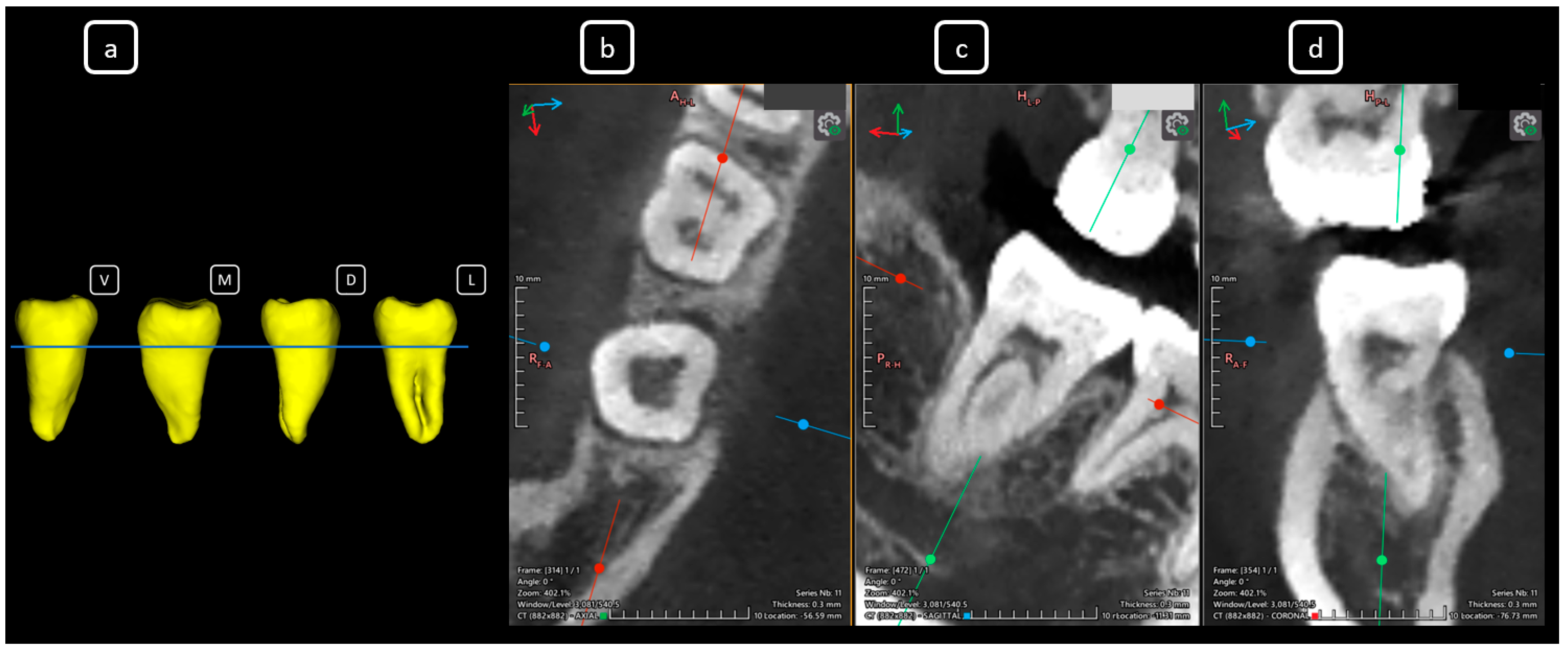 Diagnostics 15 03157 g020 Diagnostics 15 03157 g020