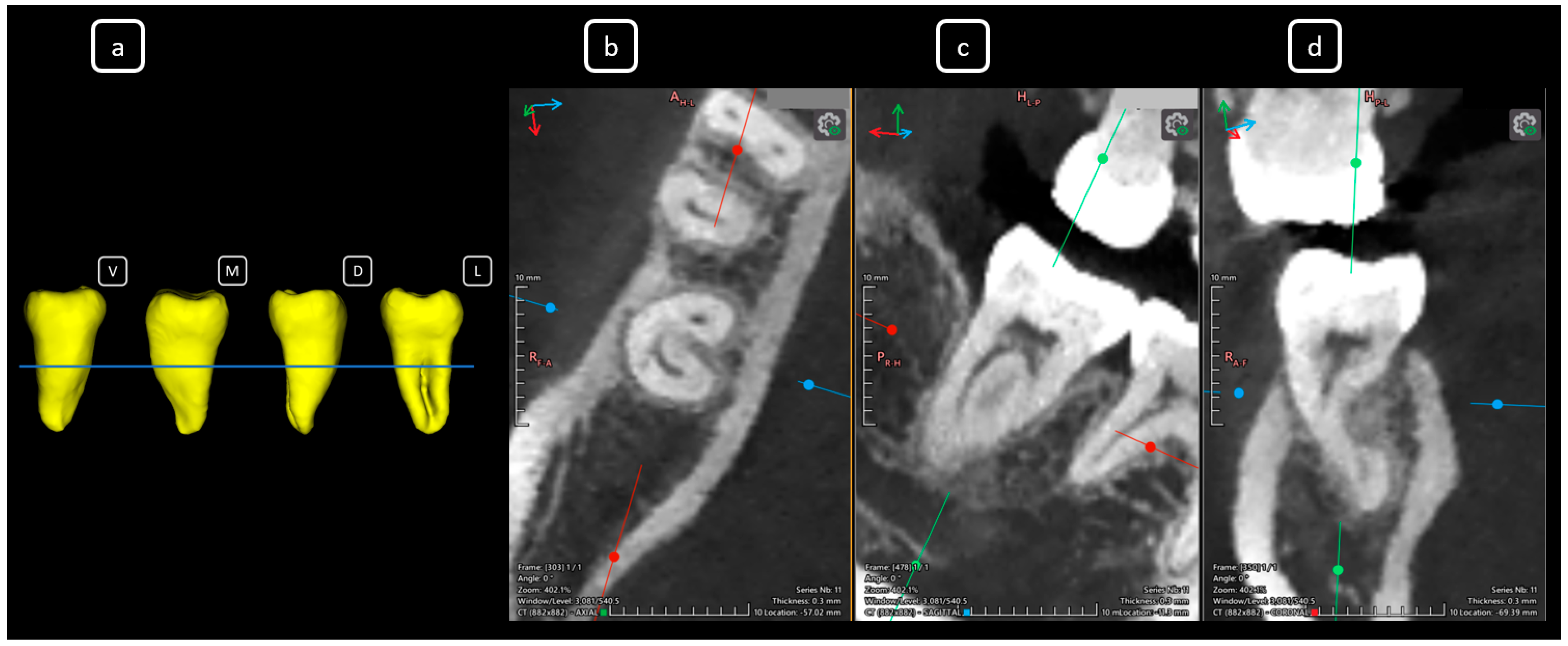 Diagnostics 15 03157 g021 Diagnostics 15 03157 g021