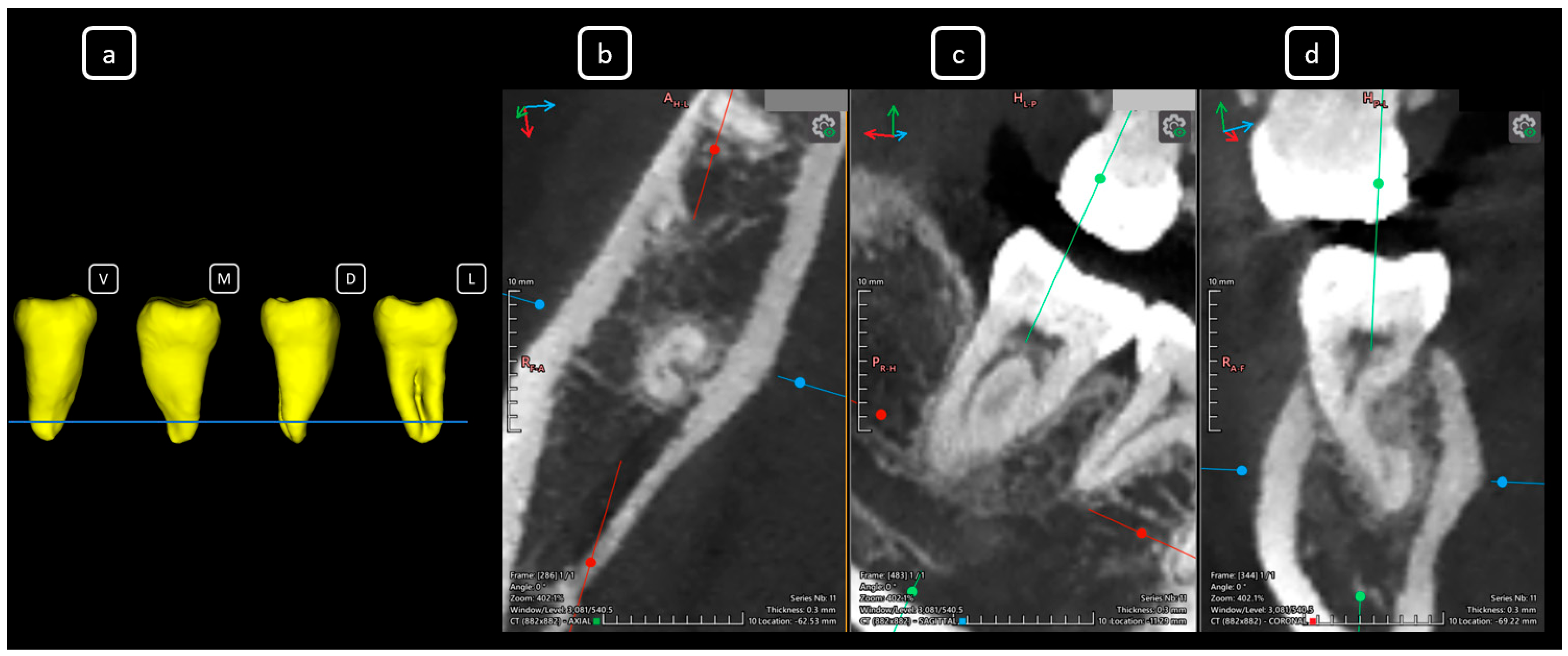 Diagnostics 15 03157 g022 Diagnostics 15 03157 g022