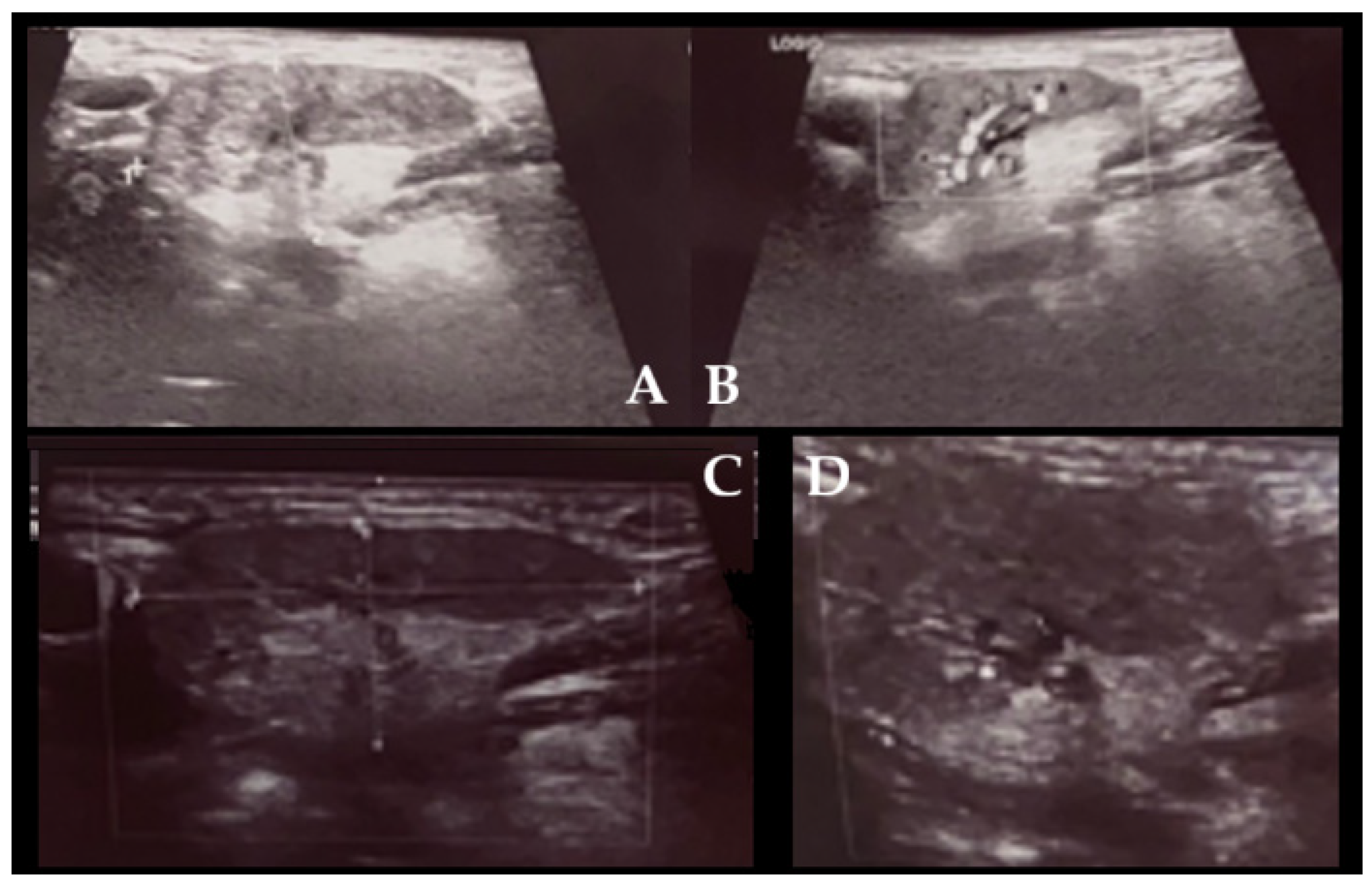 Diagnostics 15 03159 g001 Diagnostics 15 03159 g001