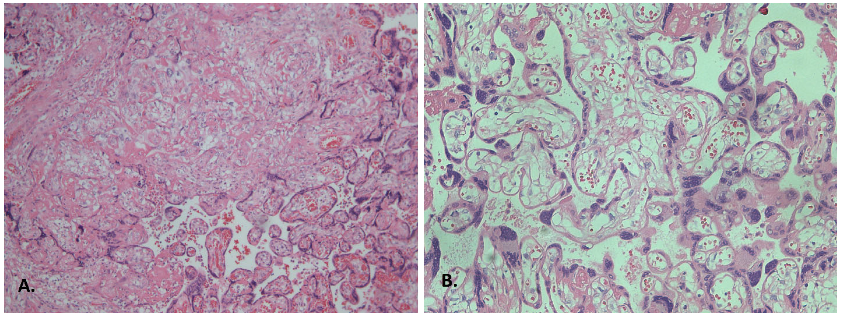 Diagnostics 15 03188 g001 Diagnostics 15 03188 g001