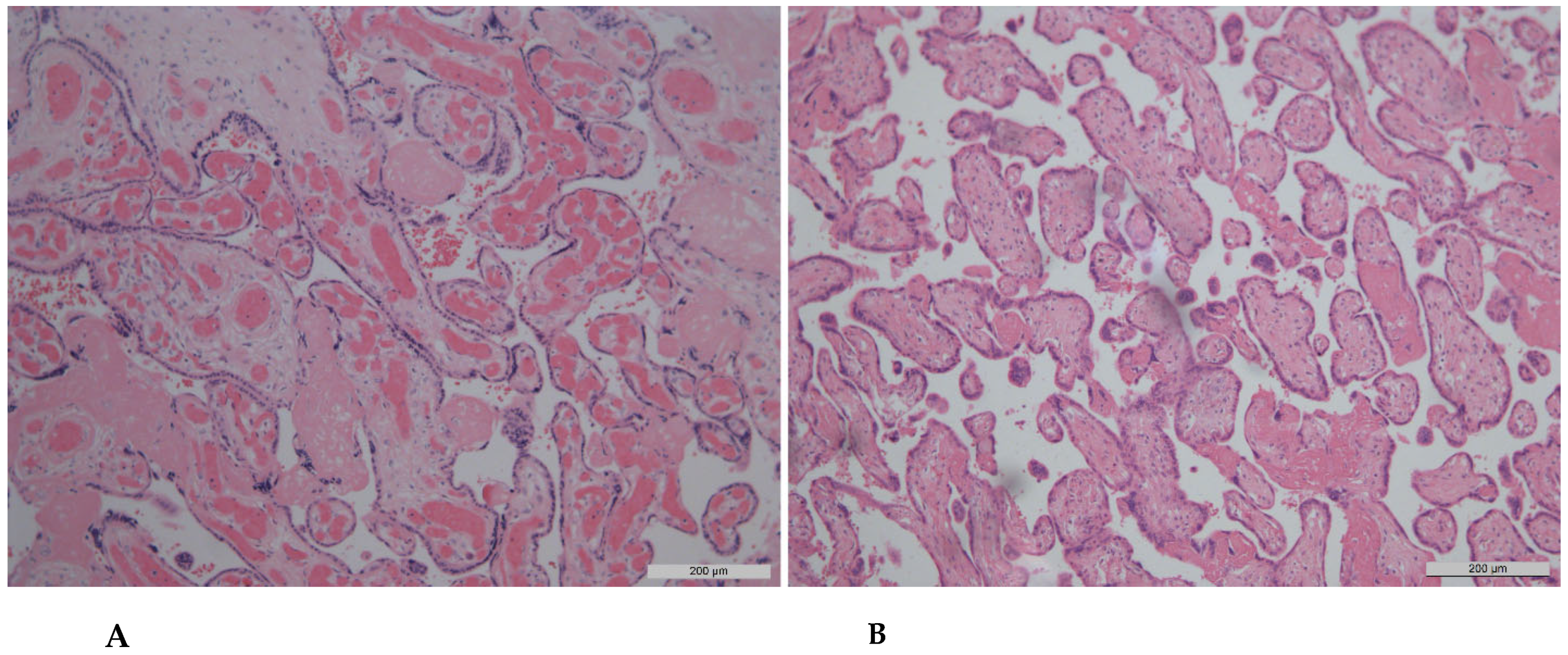 Diagnostics 15 03188 g002 Diagnostics 15 03188 g002
