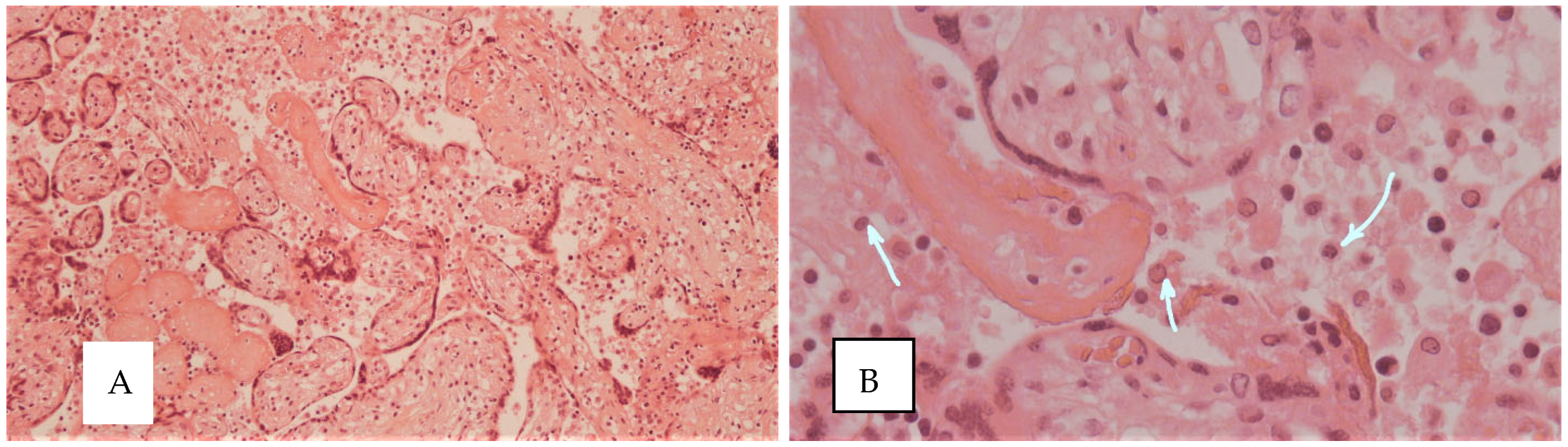 Diagnostics 15 03188 g003 Diagnostics 15 03188 g003