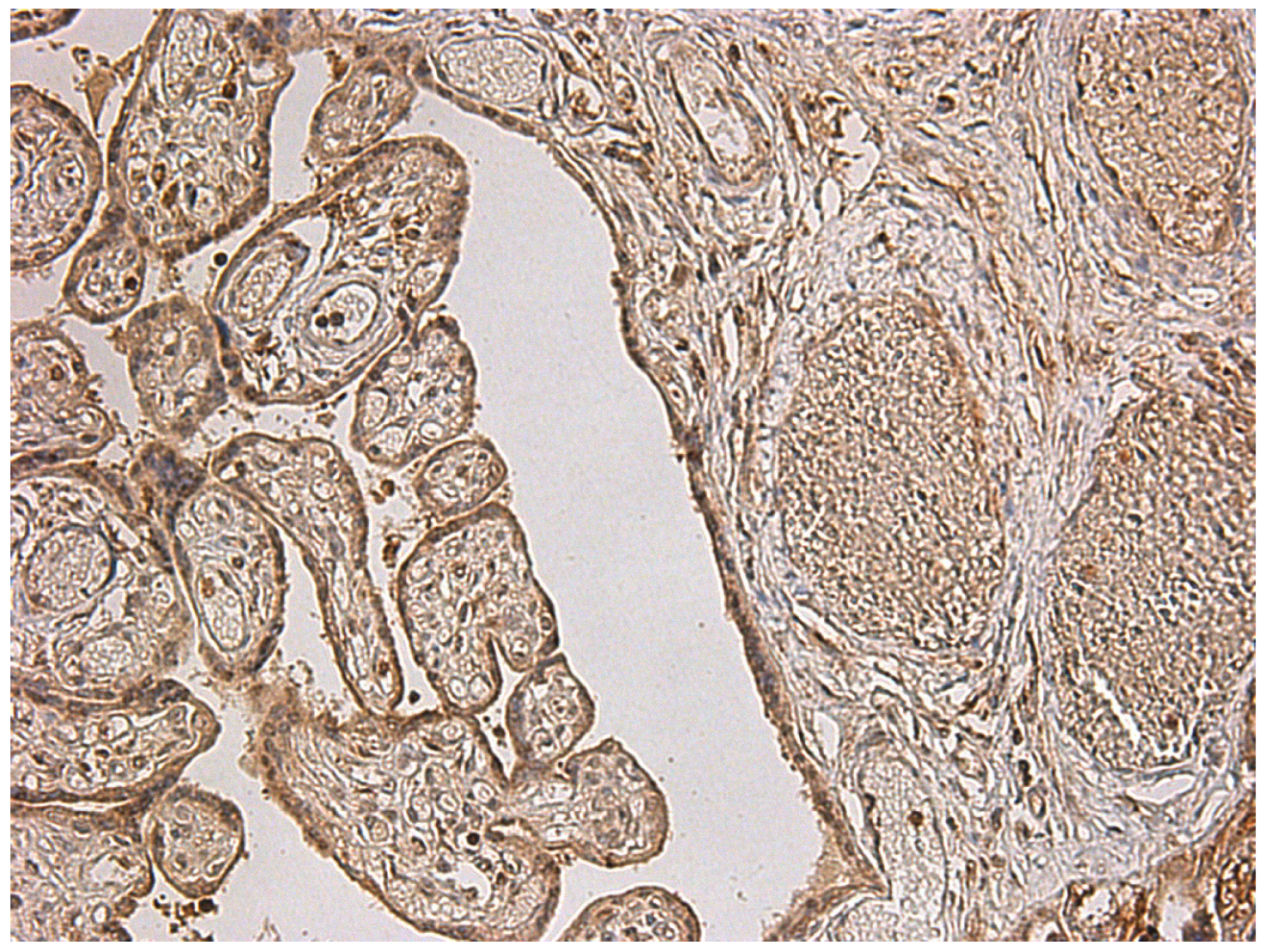 Diagnostics 15 03188 g005 Diagnostics 15 03188 g005