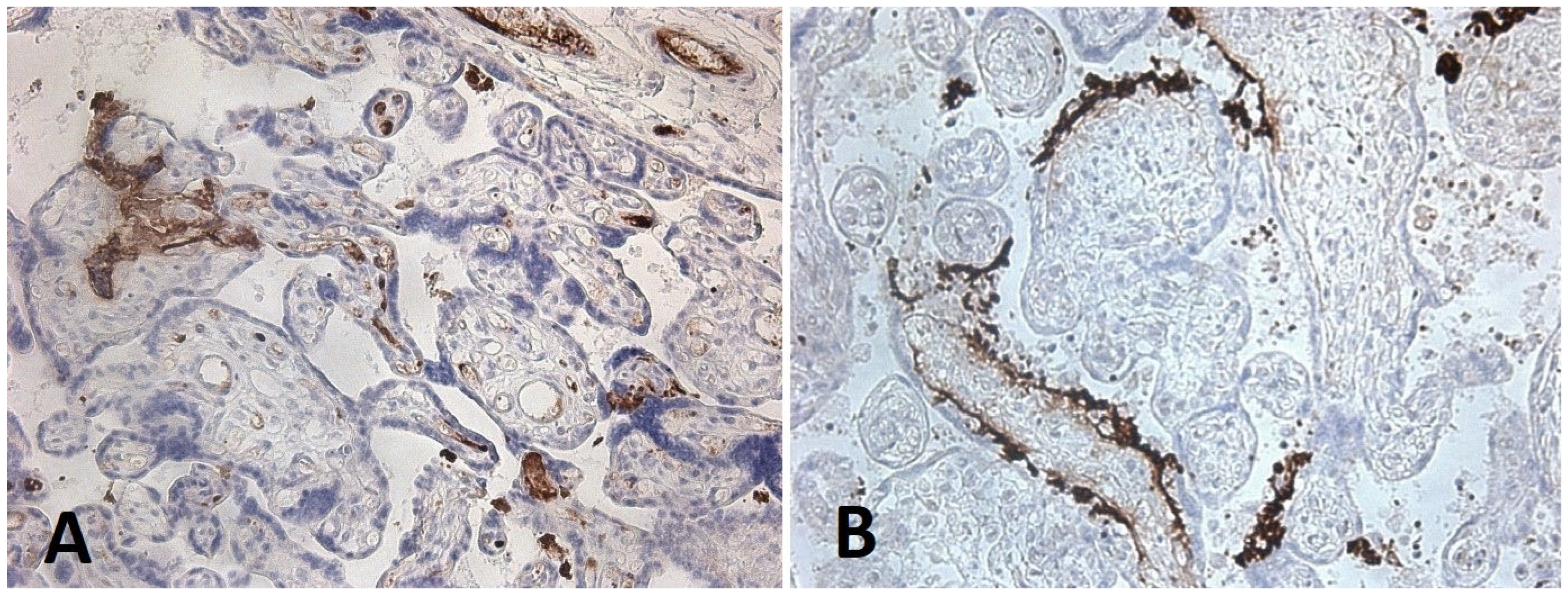 Diagnostics 15 03188 g006 Diagnostics 15 03188 g006