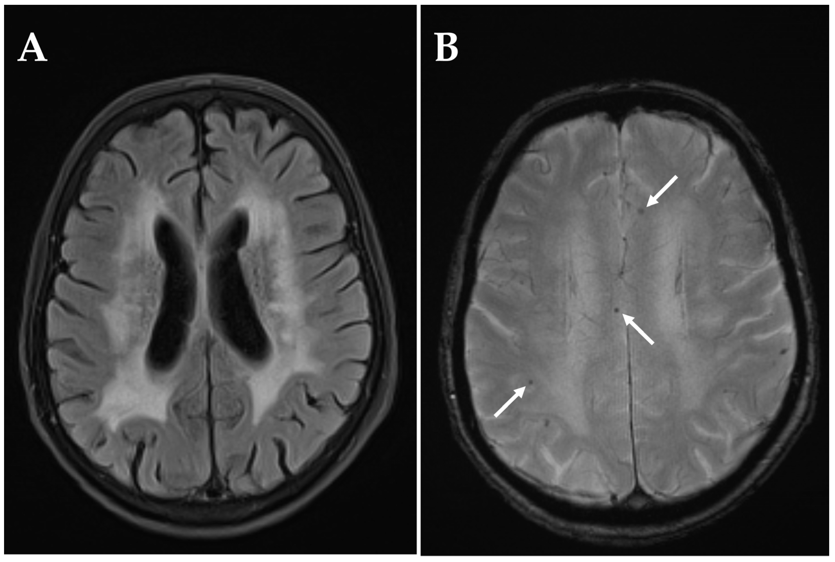Diagnostics 15 03192 g005 Diagnostics 15 03192 g005
