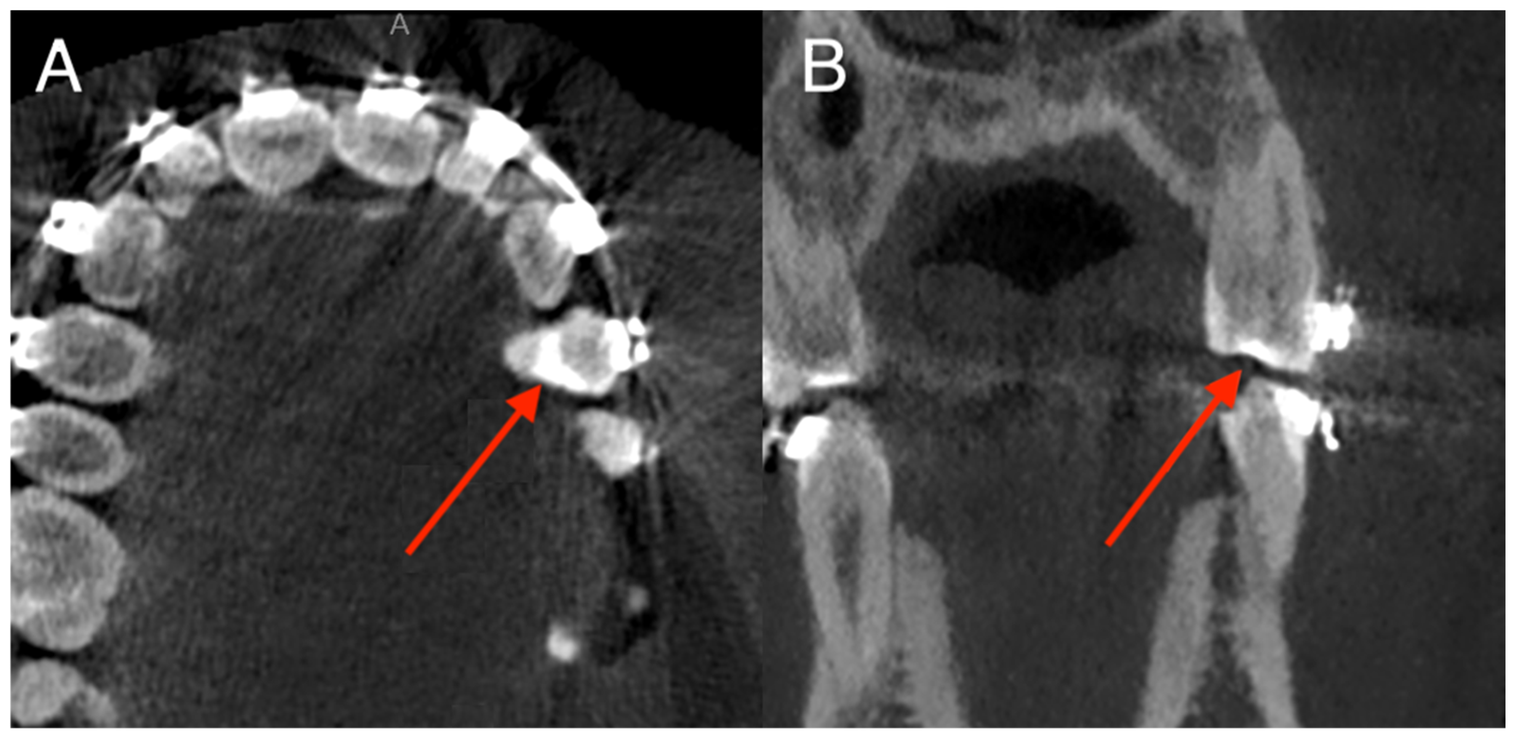 Diagnostics 15 03207 g006 Diagnostics 15 03207 g006