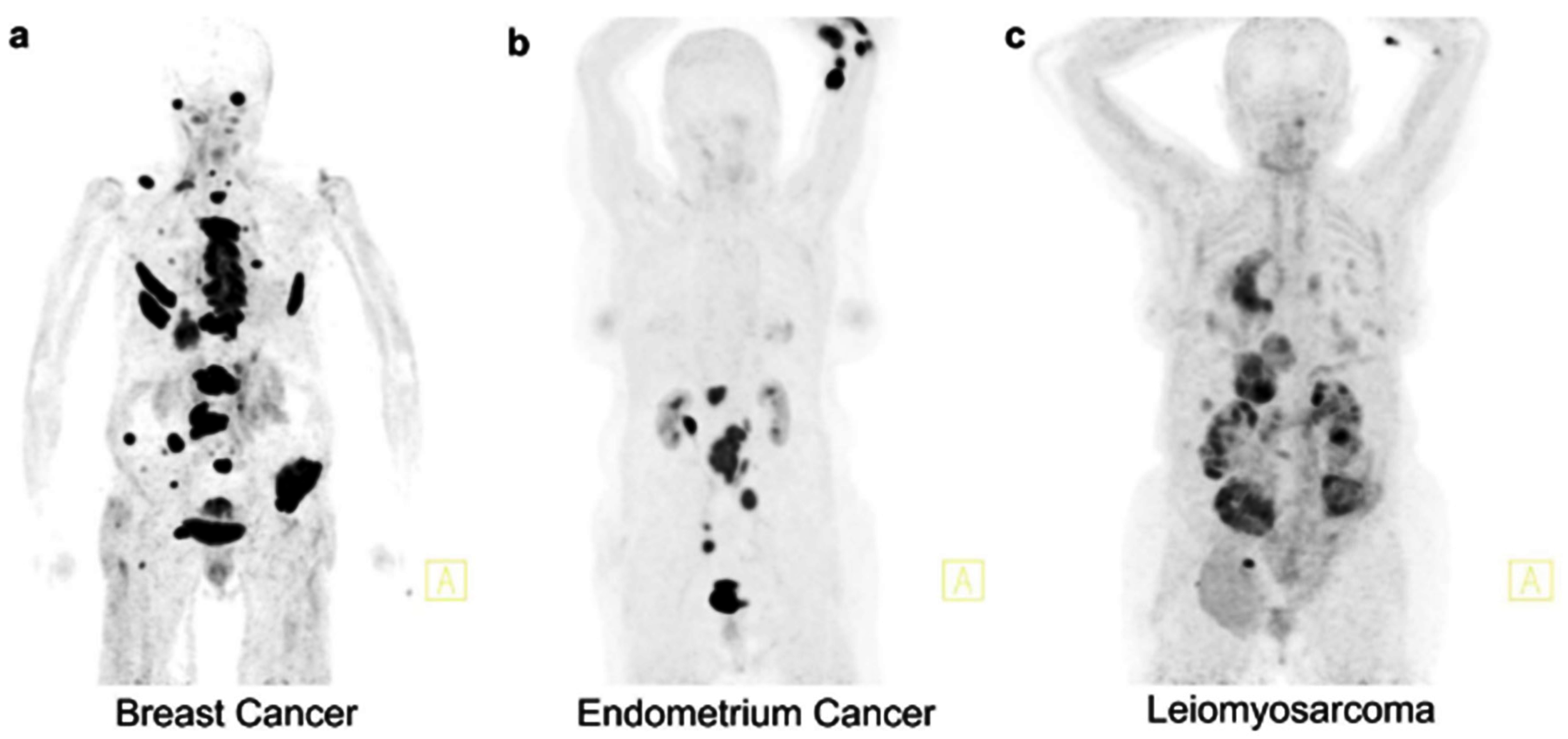 Diagnostics 15 03209 g008 Diagnostics 15 03209 g008