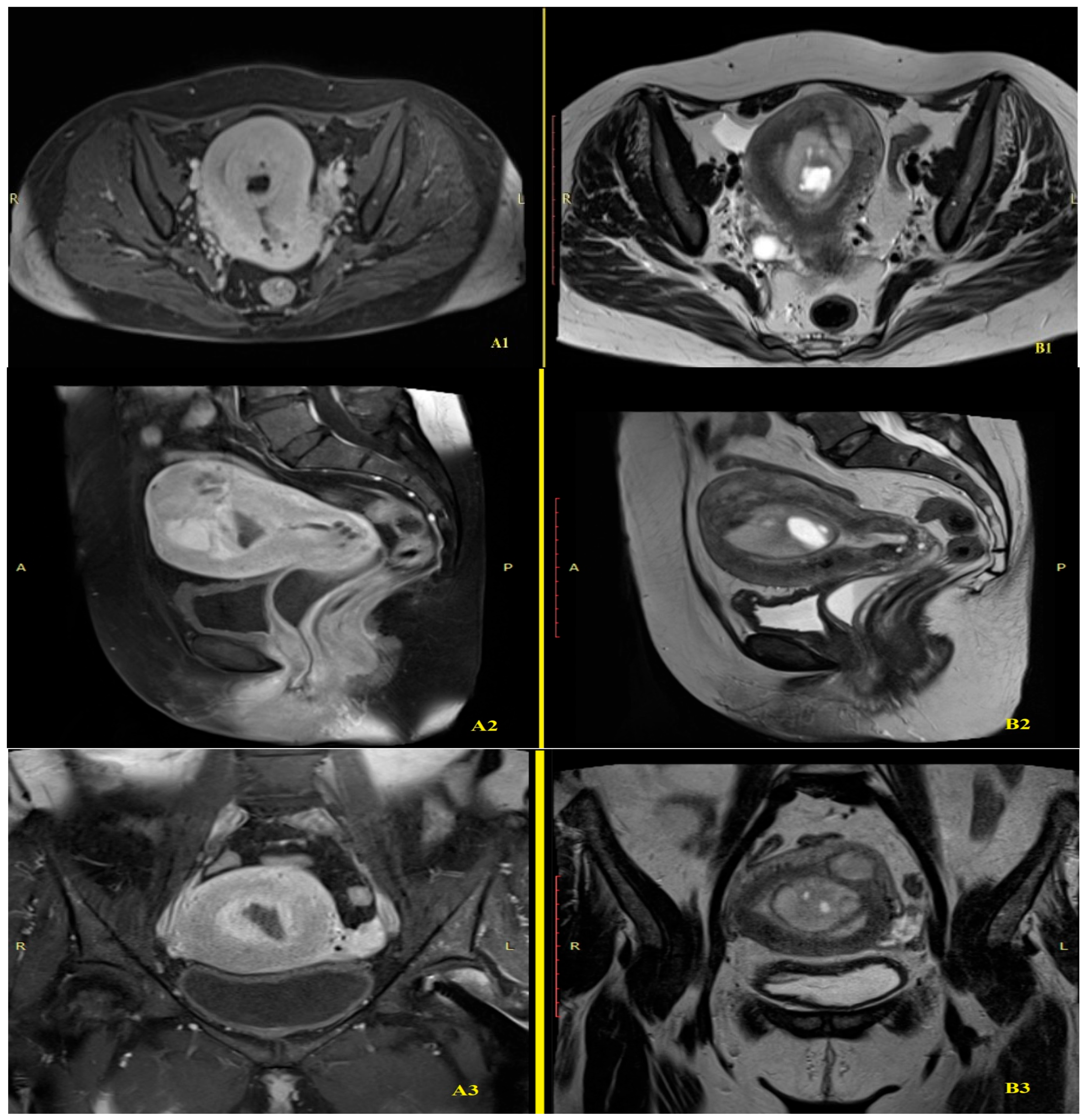 Diagnostics 15 03215 g002 Diagnostics 15 03215 g002