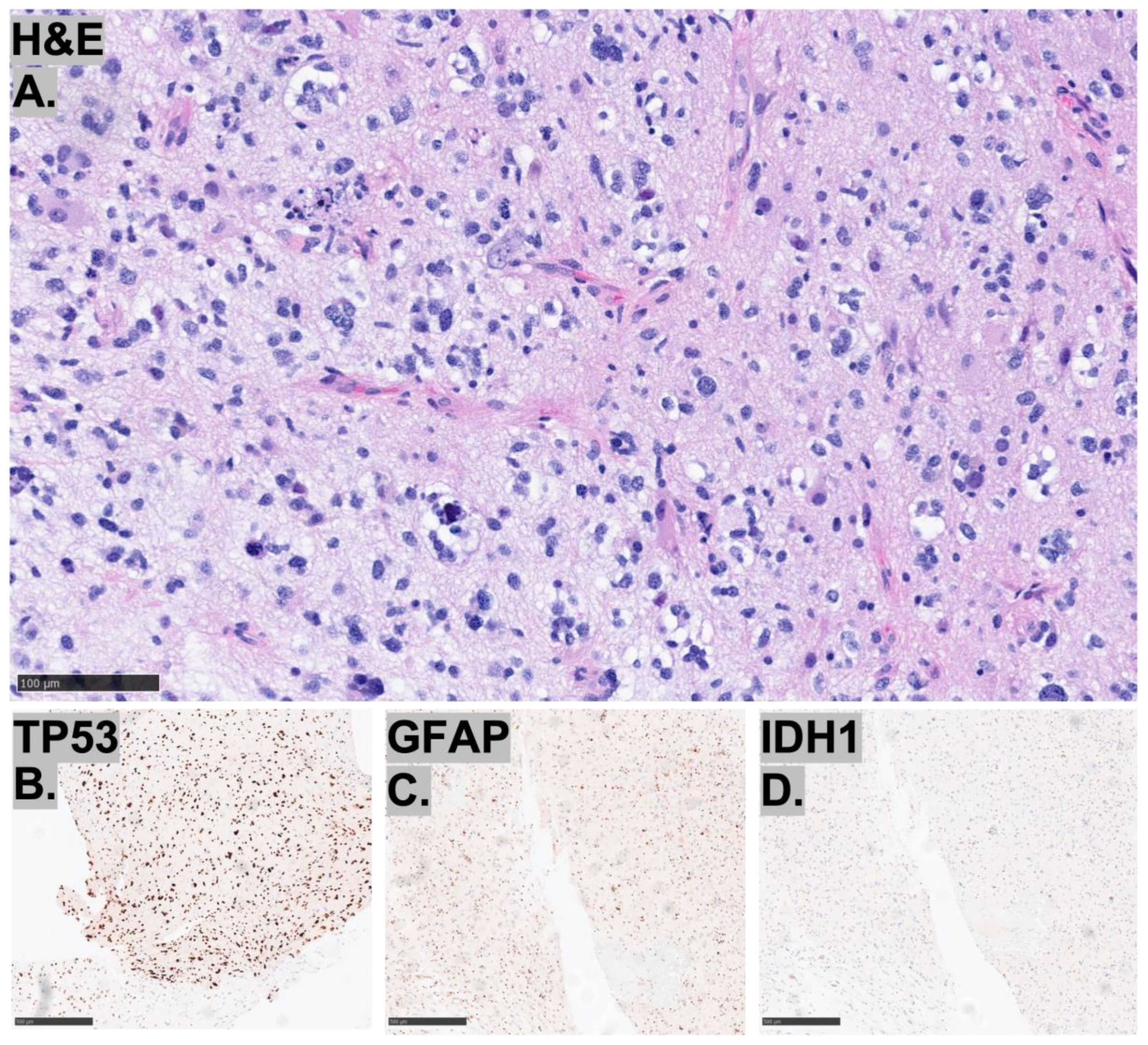 Diagnostics 15 03225 g004 Diagnostics 15 03225 g004