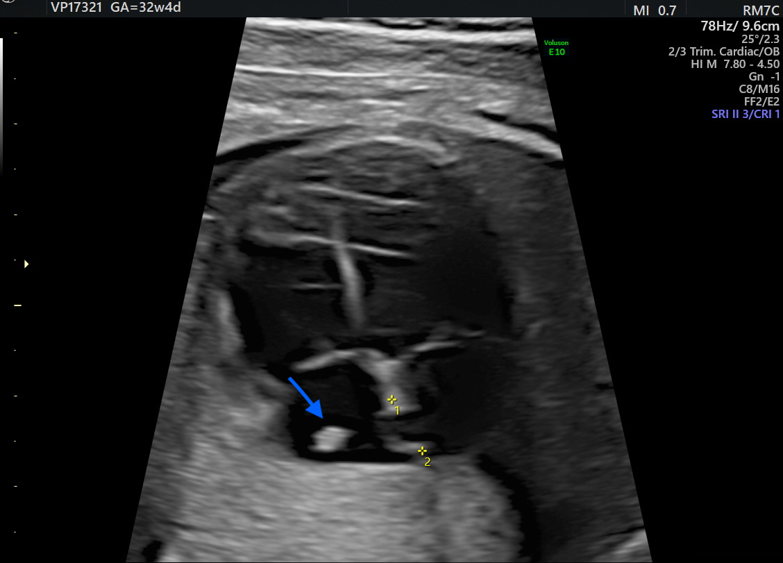 Diagnostics 16 00017 g001