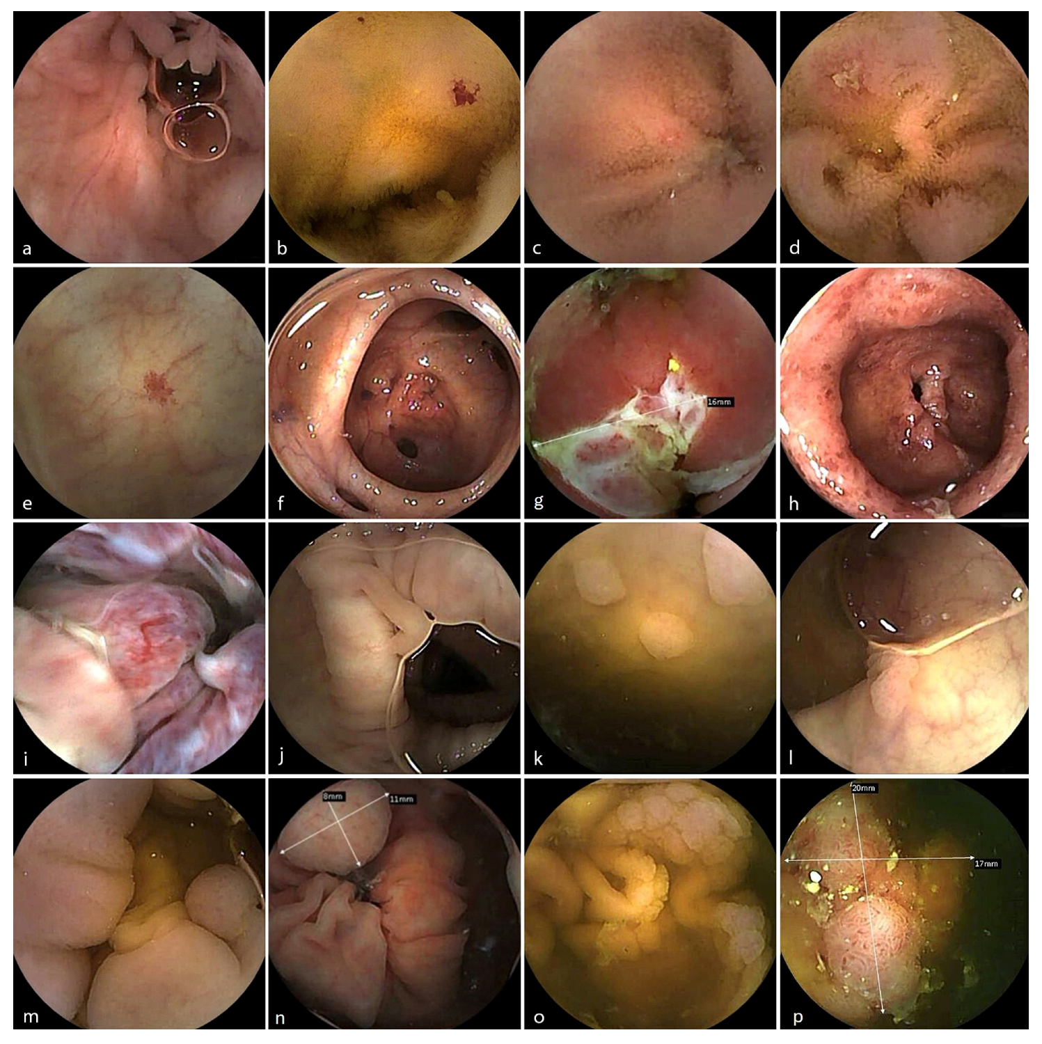 Diagnostics 16 00020 g003