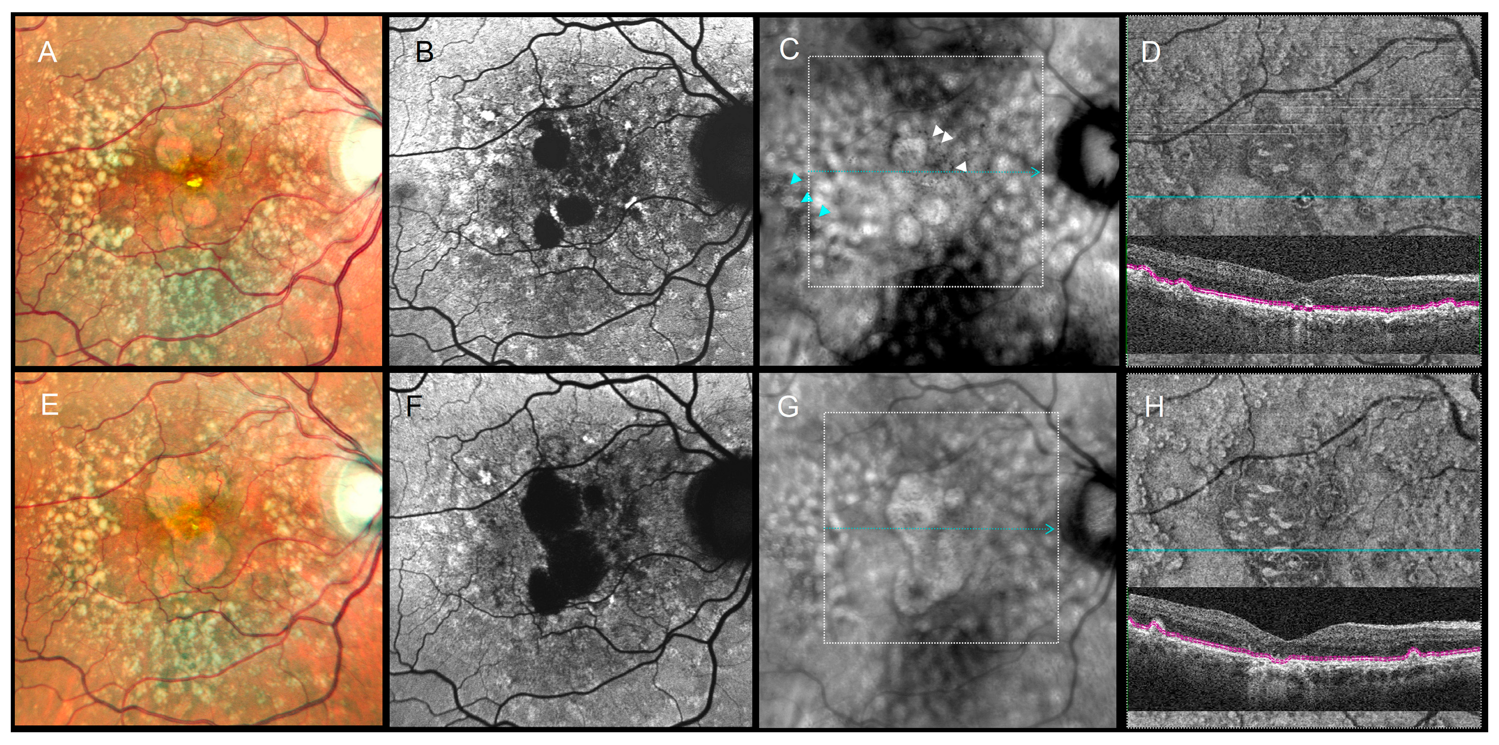 Diagnostics 16 00042 g005 Diagnostics 16 00042 g005