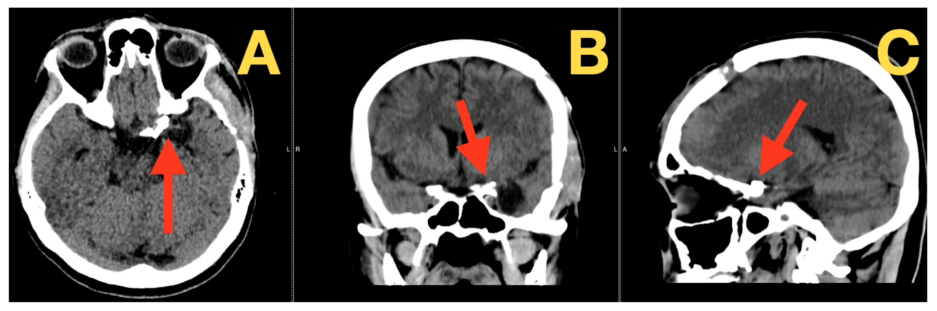Diagnostics 16 00073 g004