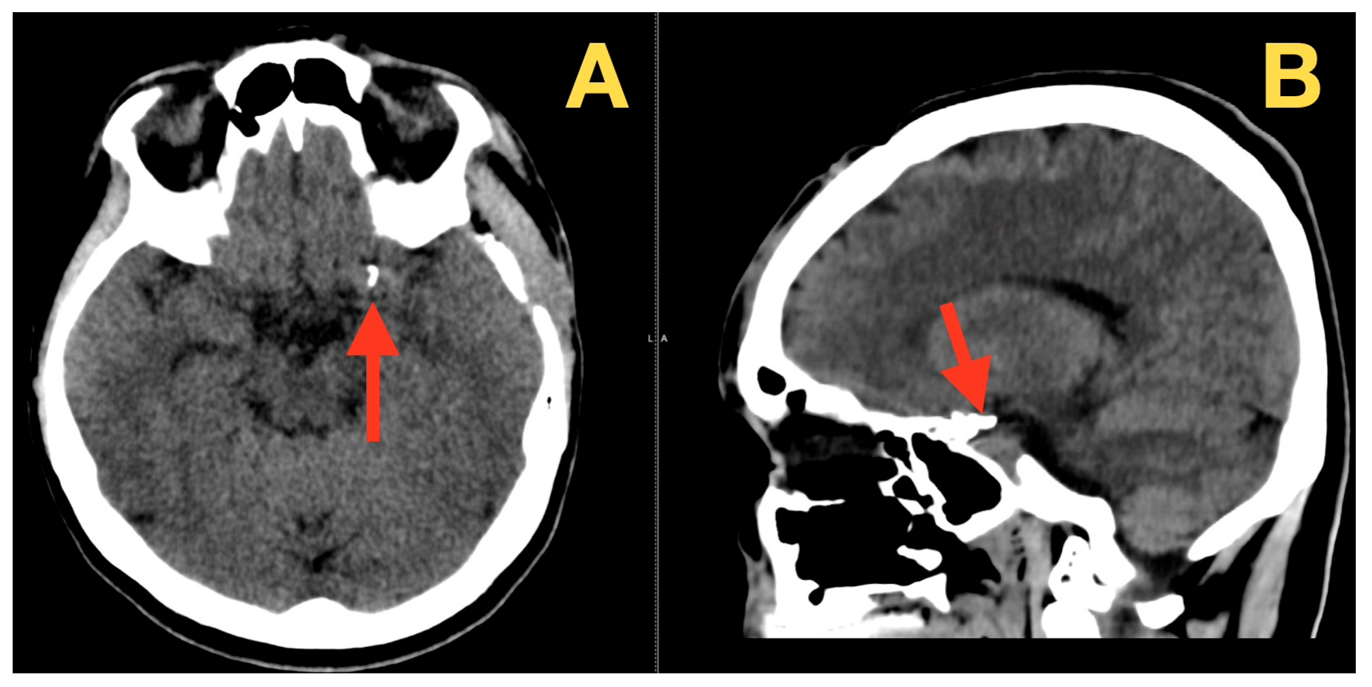 Diagnostics 16 00073 g005