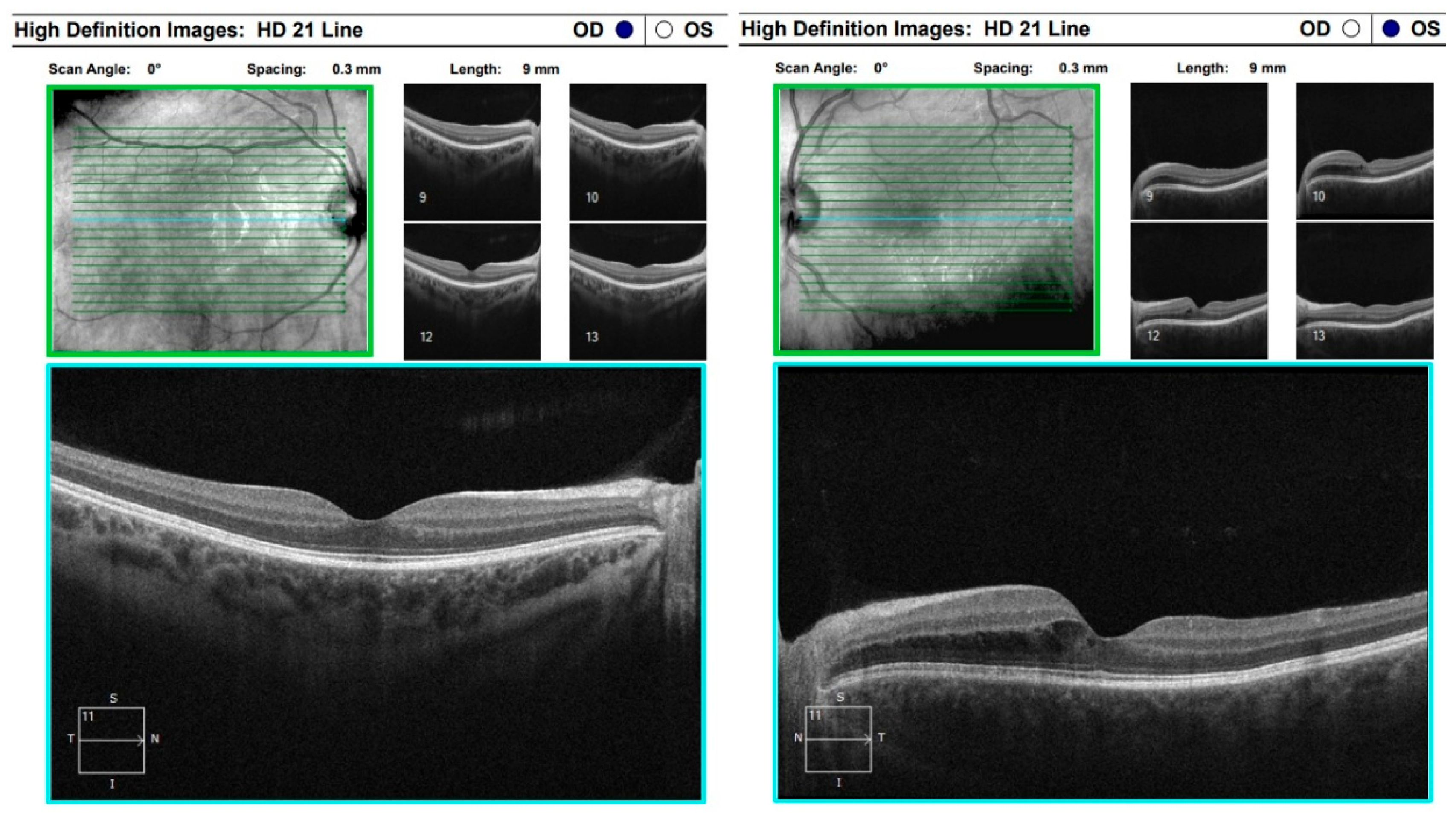 Diagnostics 16 00141 g013