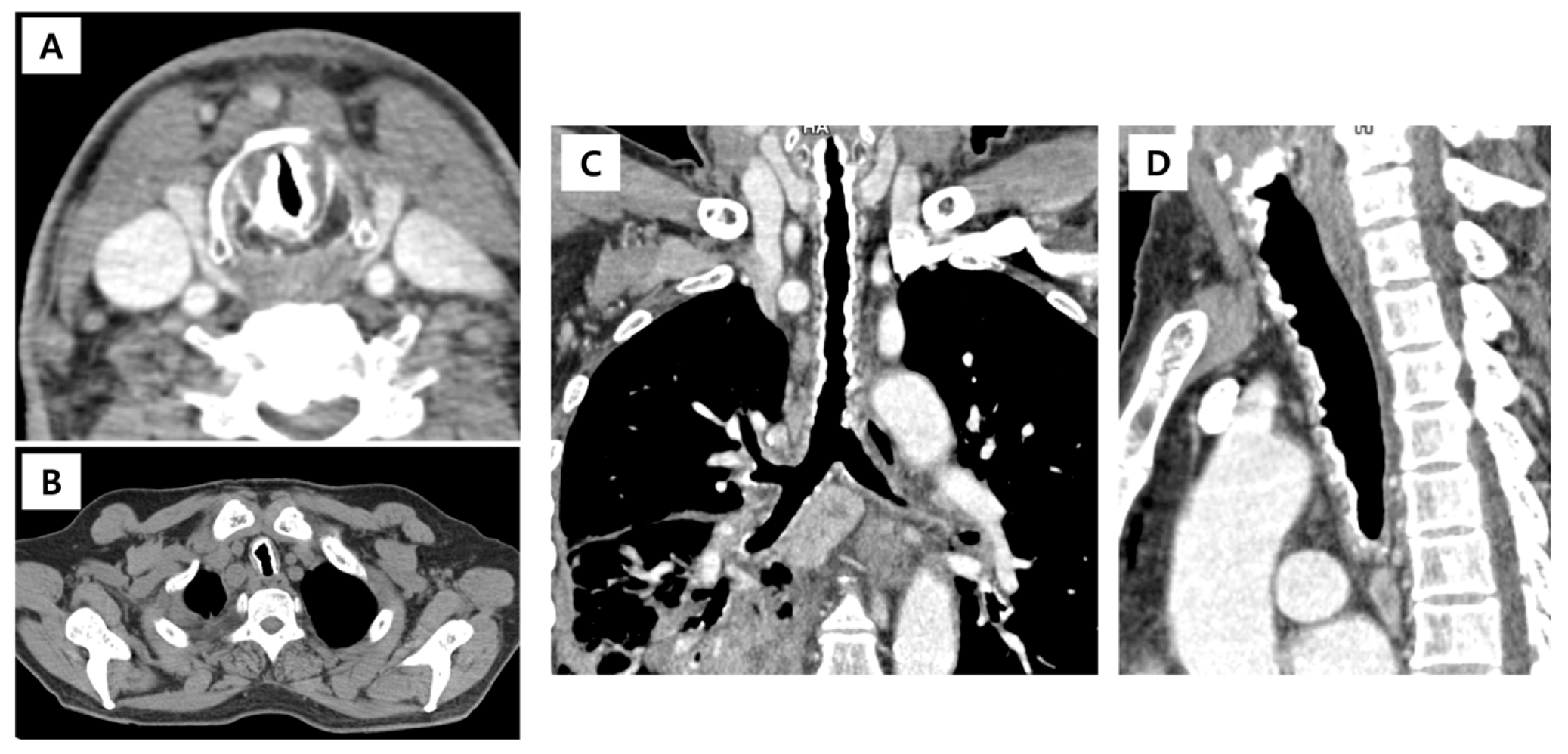 Diagnostics 16 00210 g002 Diagnostics 16 00210 g002