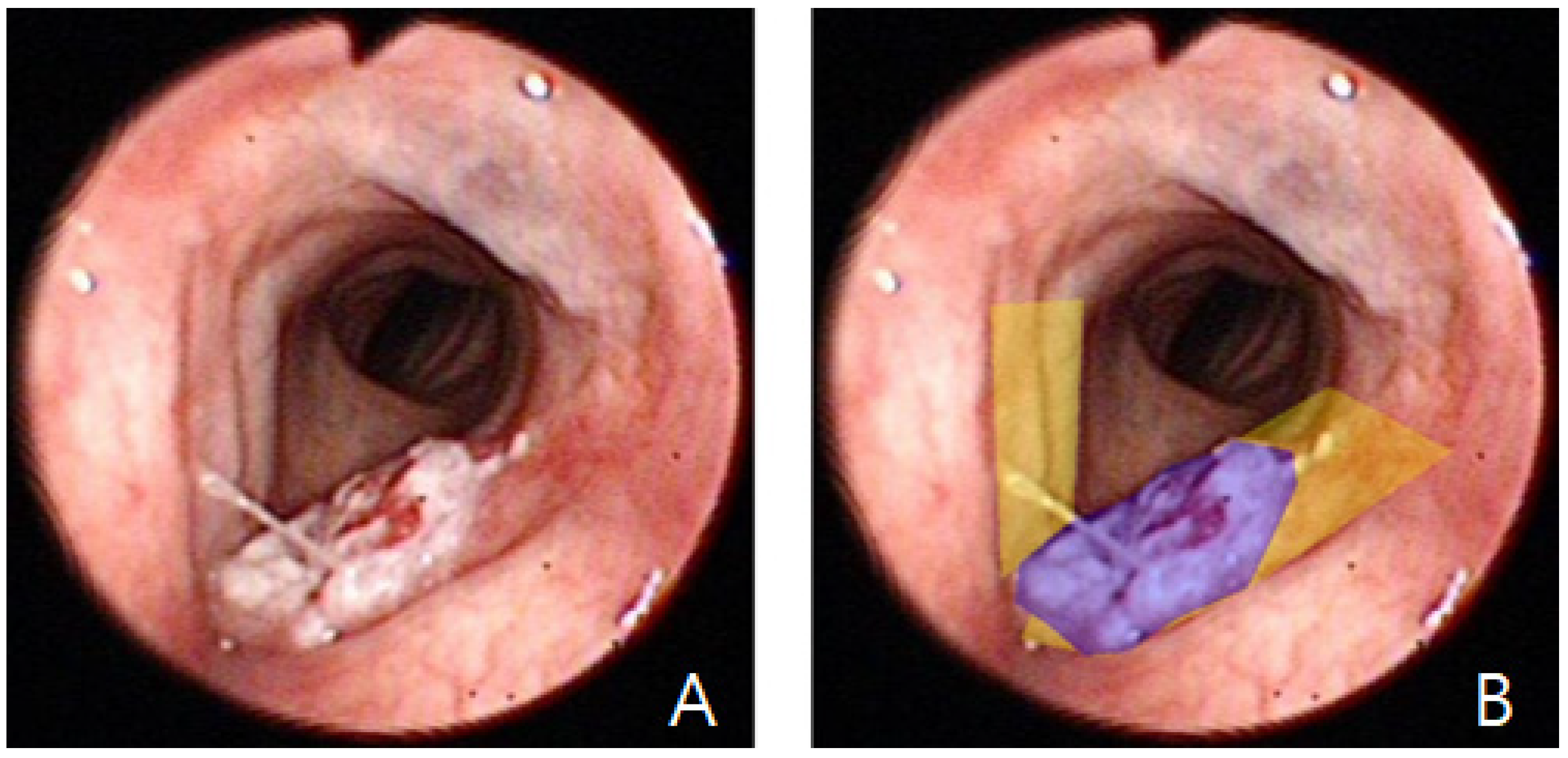 Diagnostics 16 00227 g001
