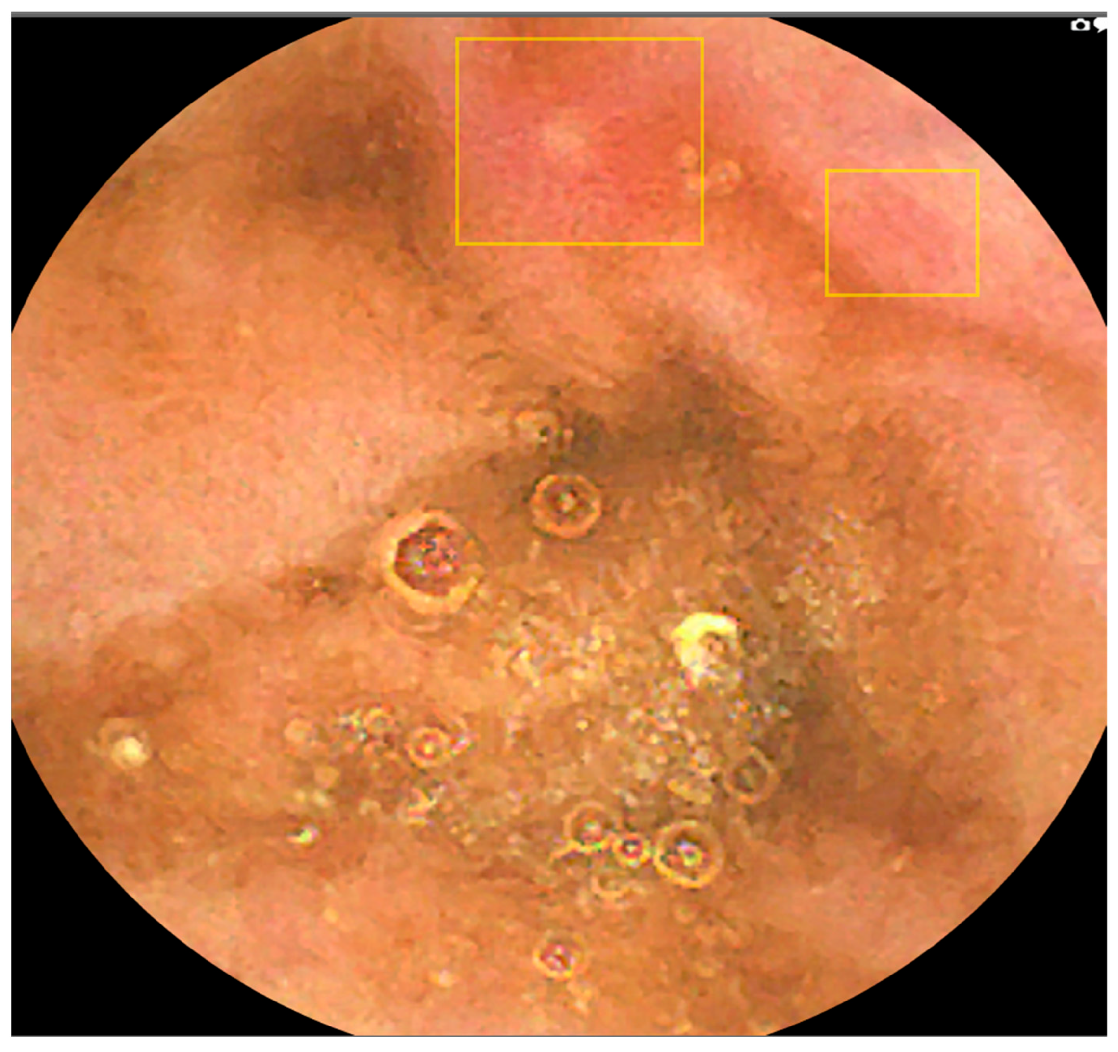 Diagnostics 16 00239 g007 Diagnostics 16 00239 g007
