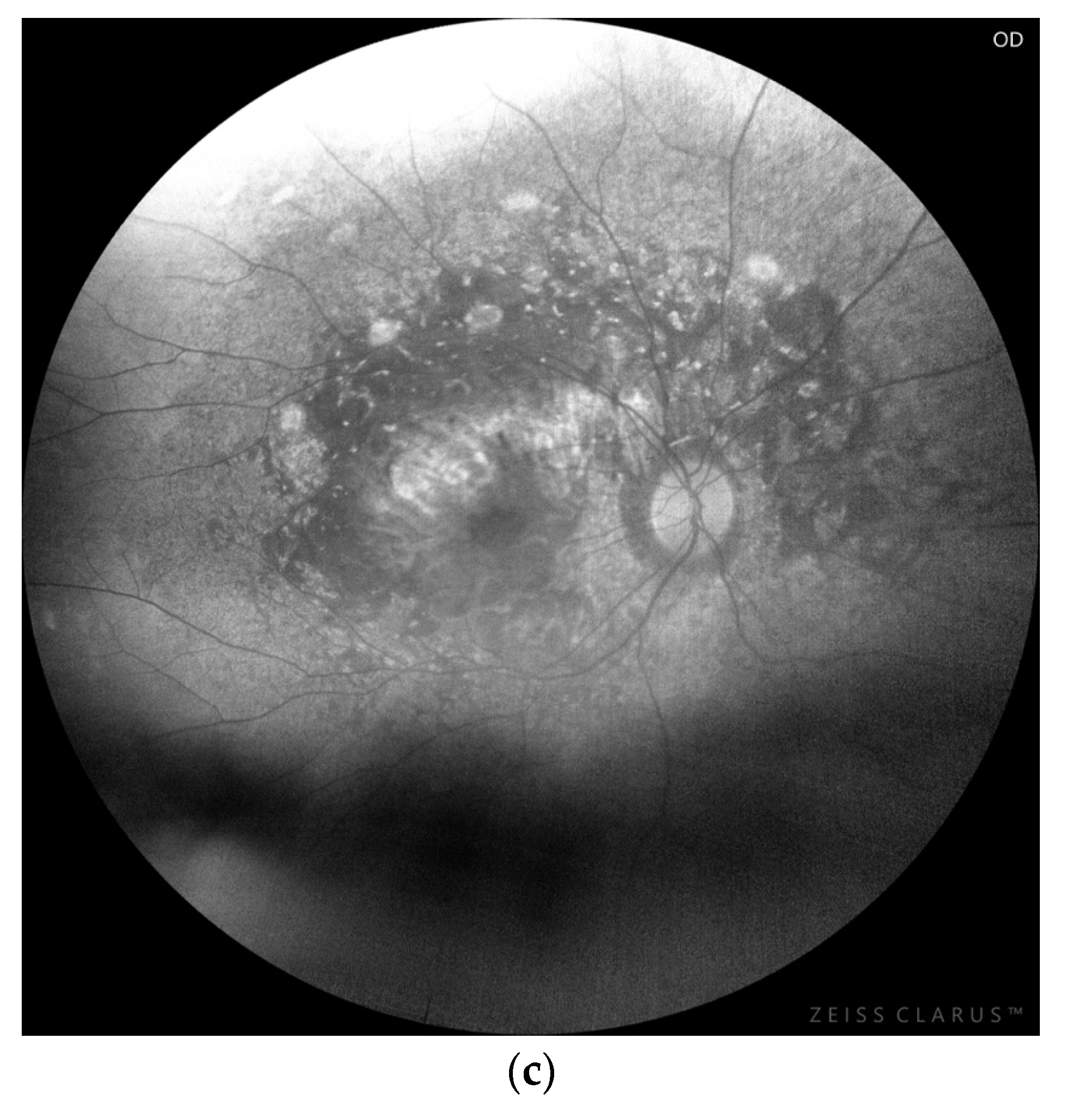 Diagnostics 16 00295 g002b