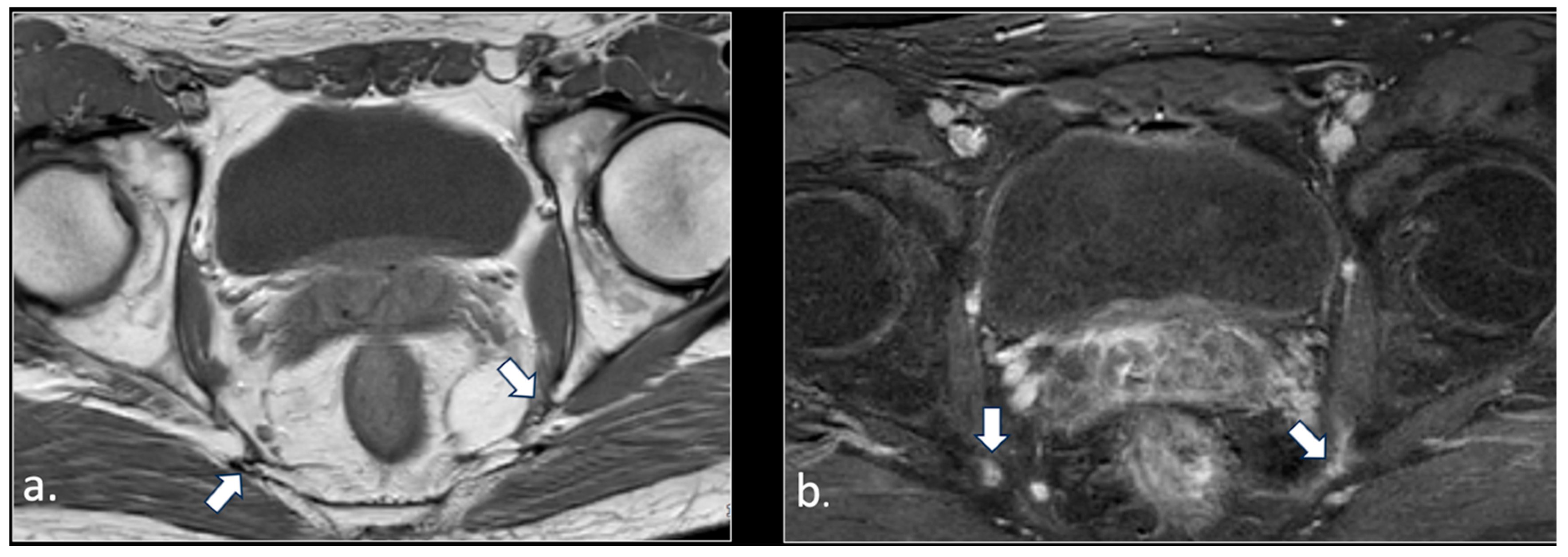 Diagnostics 16 00326 g004