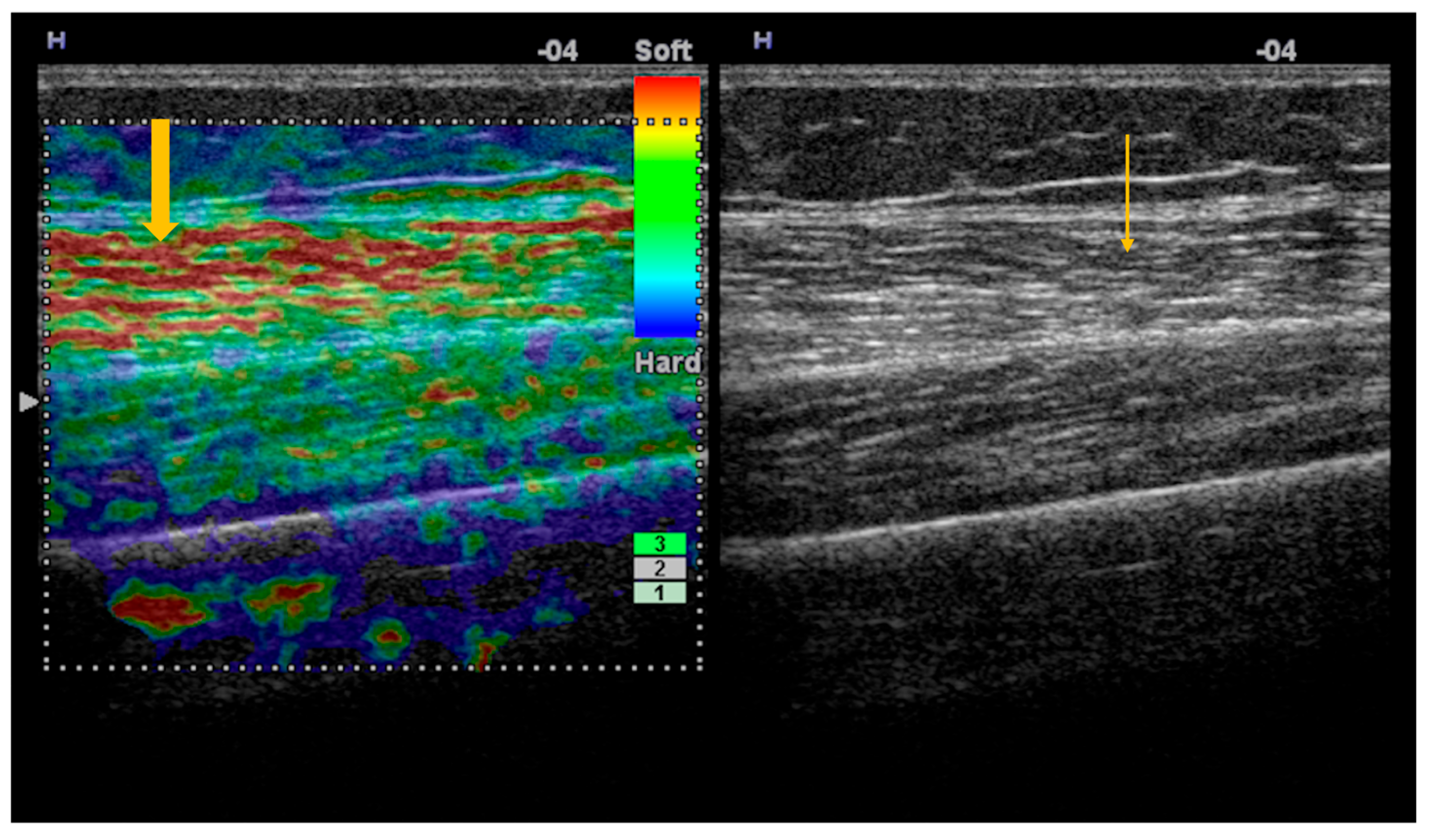 Diagnostics 16 00358 g001 Diagnostics 16 00358 g001